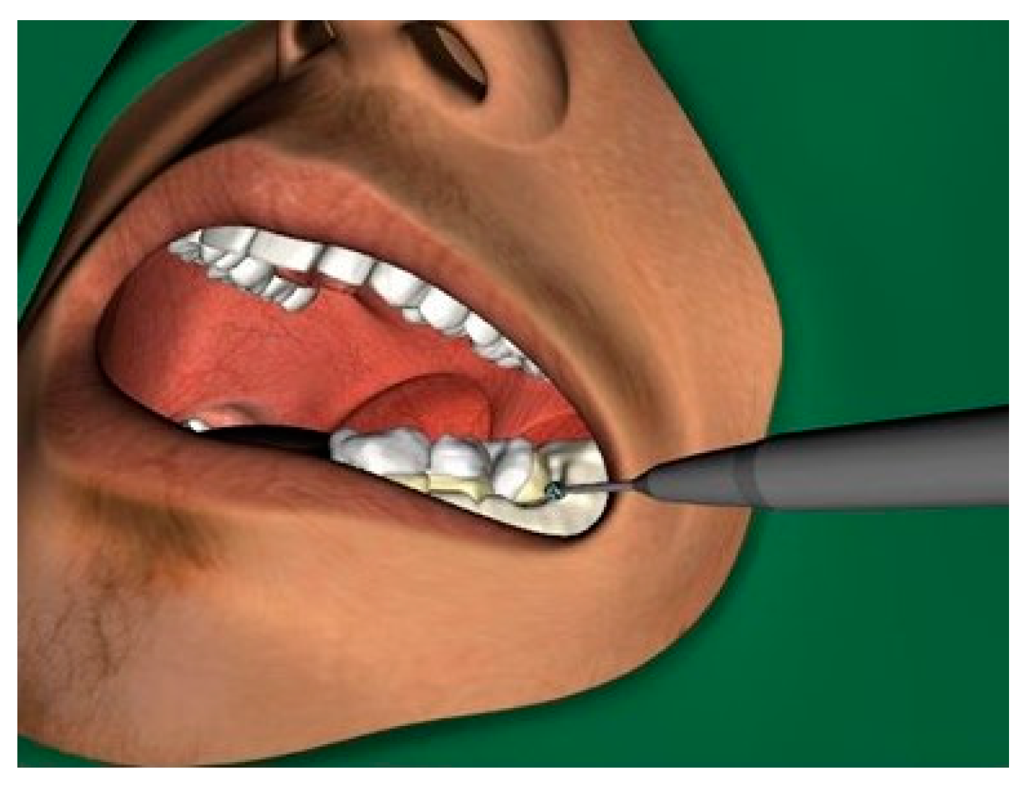 Ijerph 18 01827 g004 Ijerph 18 01827 g004