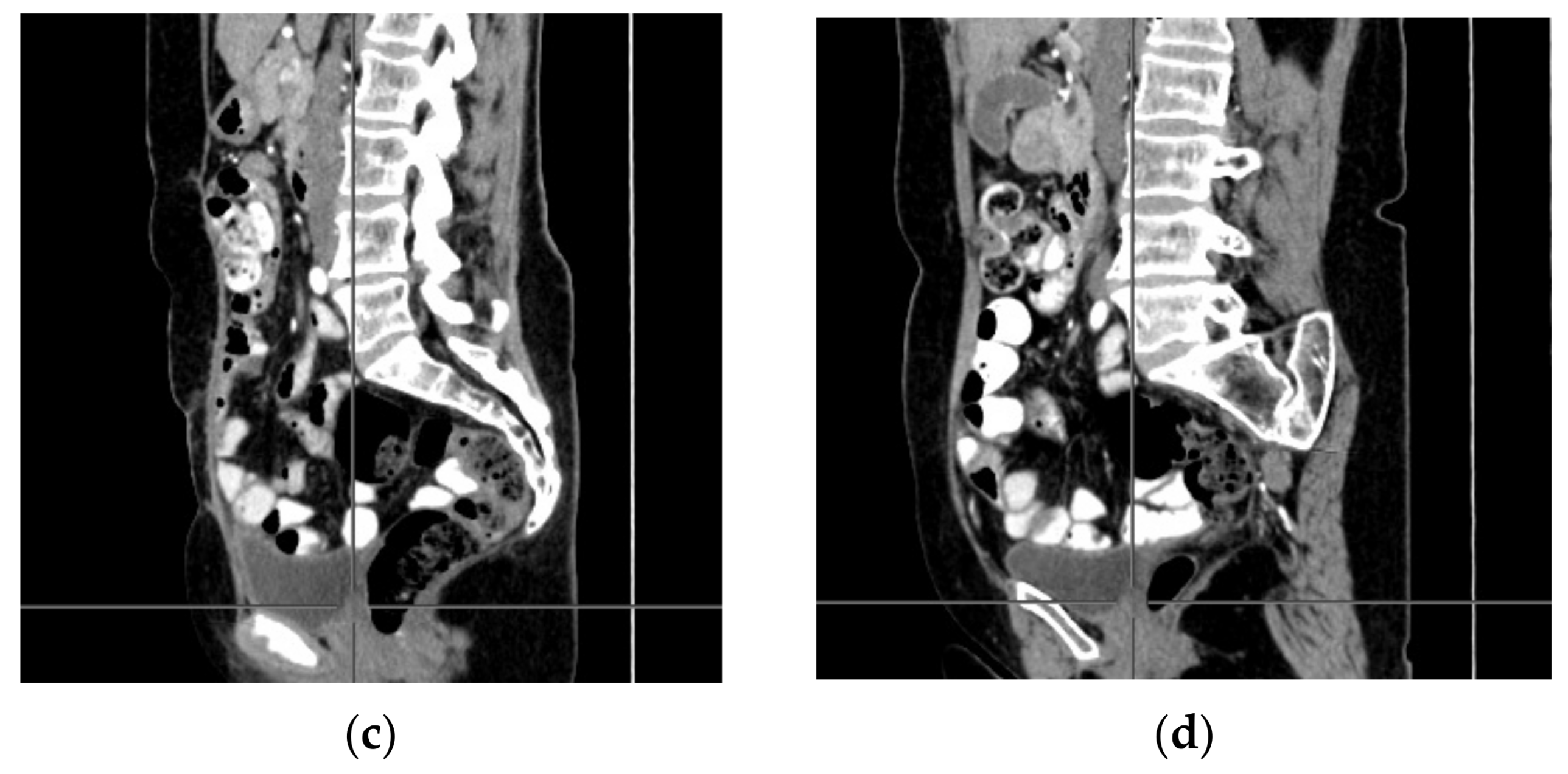 Ijerph 18 03430 g002b Ijerph 18 03430 g002b