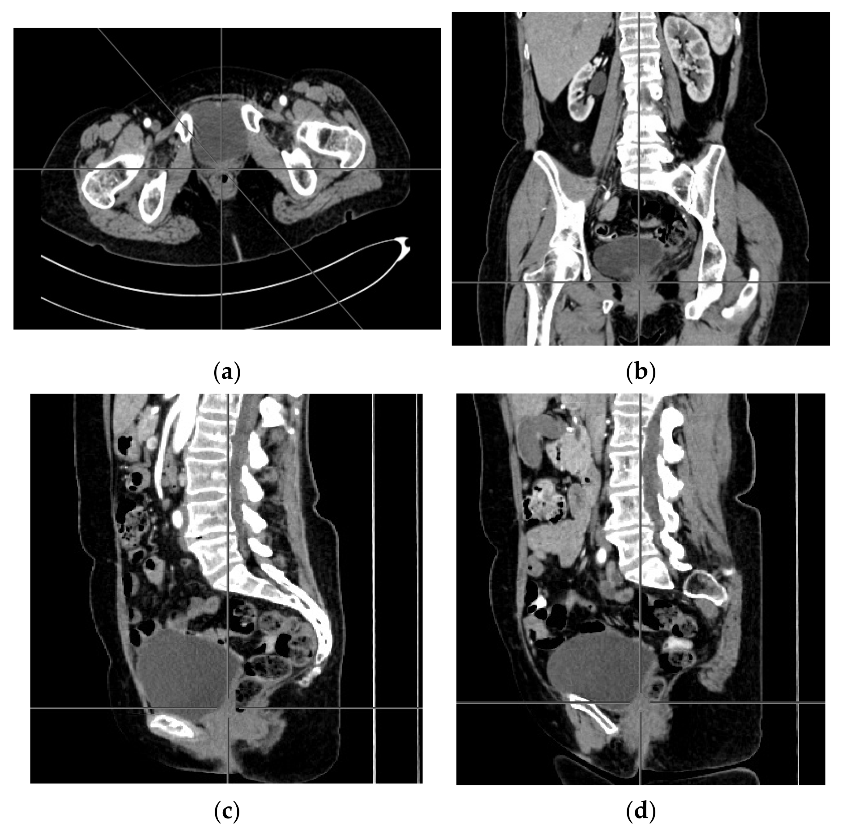 Ijerph 18 03430 g003 Ijerph 18 03430 g003