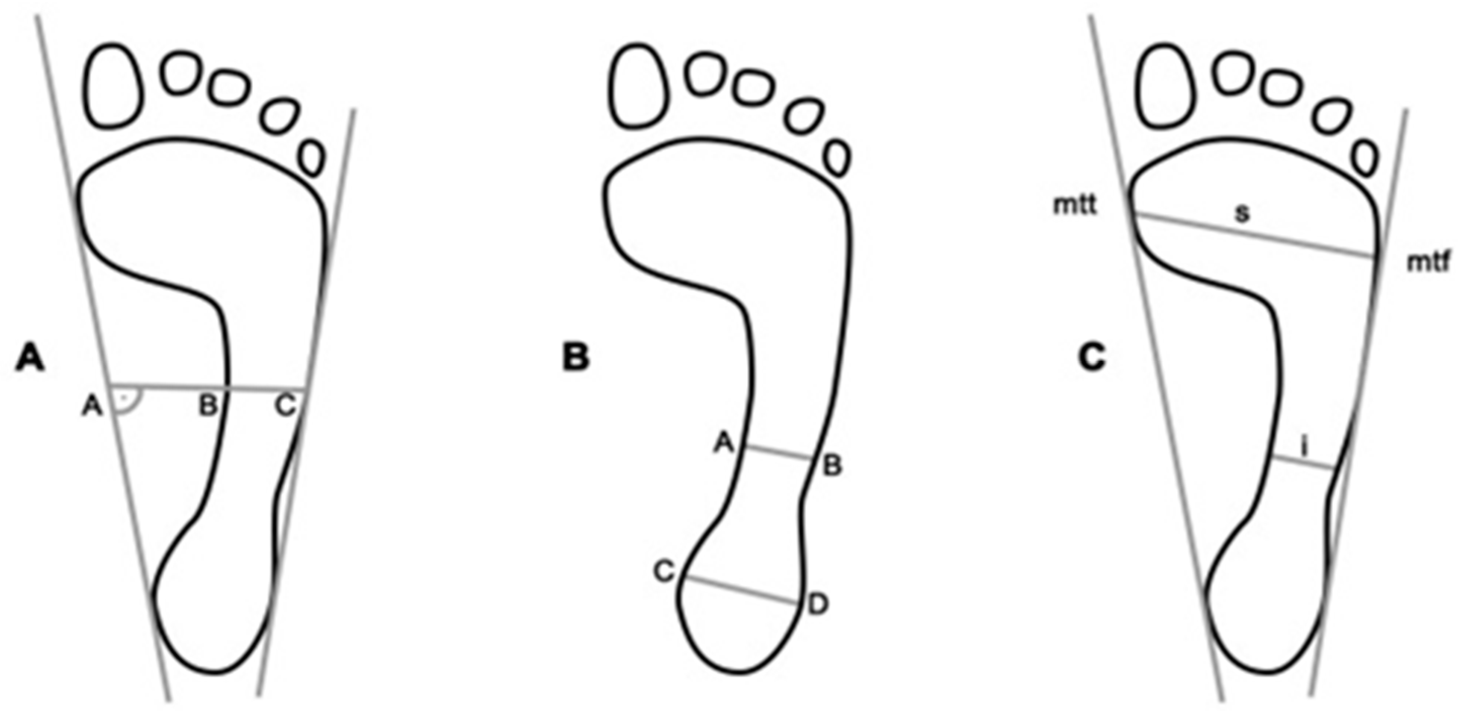 IJERPH | Free Full-Text | Assessment of the Foot's Longitudinal Arch by  Different Indicators and Their Correlation with the Foot Loading Paradigm  in School-Aged Children: A Cross Sectional Study