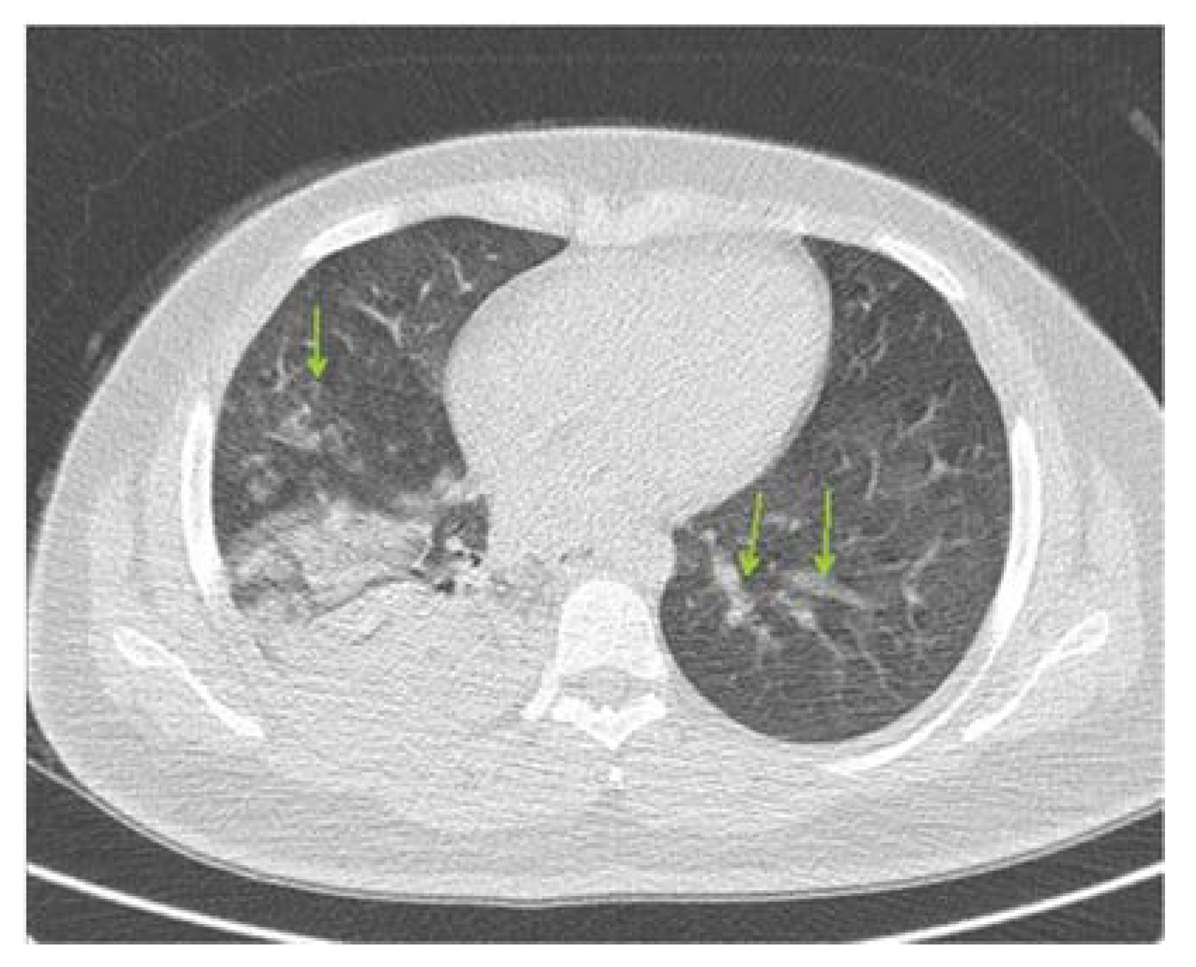 Ijerph 18 05882 g001 Ijerph 18 05882 g001