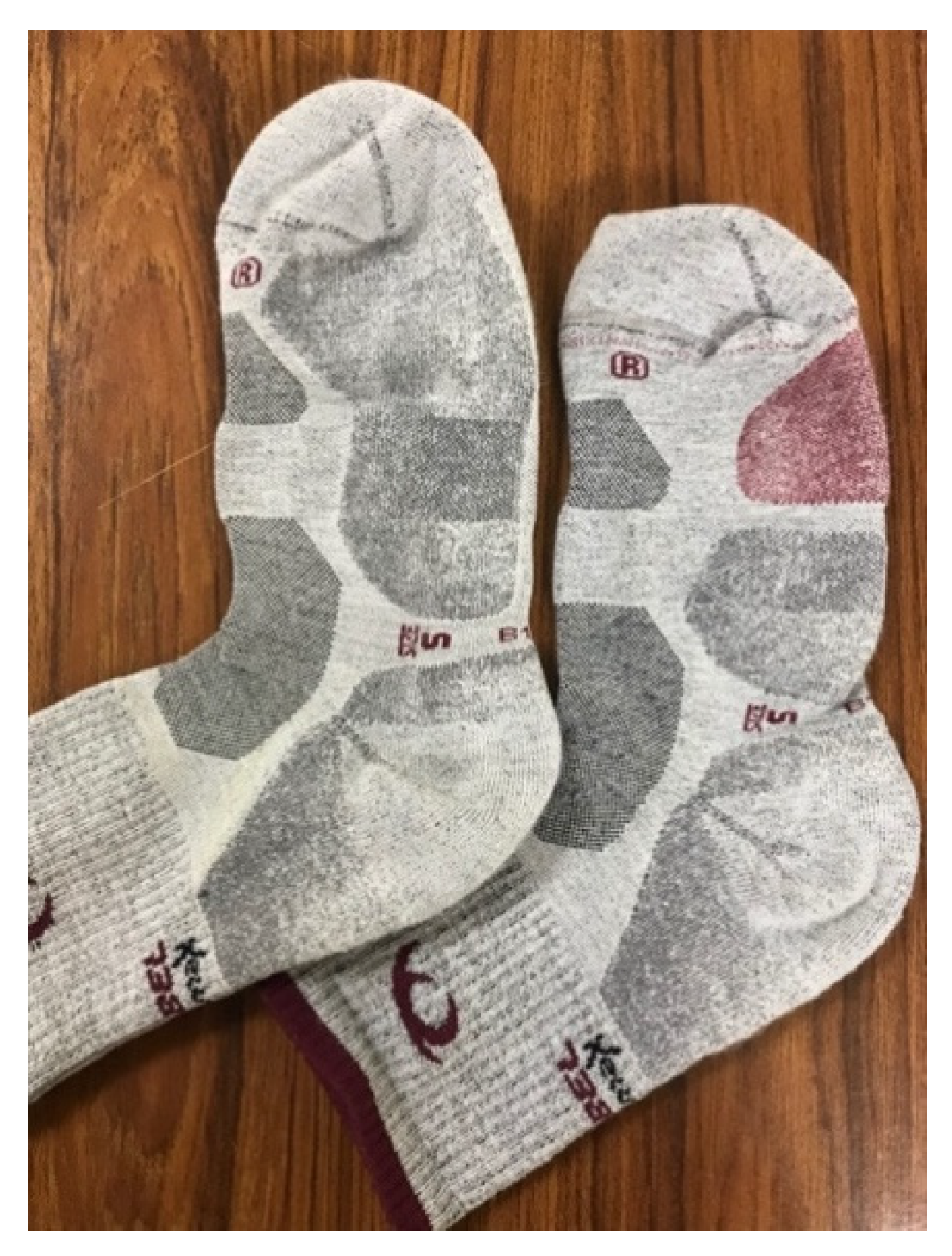 IJERPH | Free Full-Text | Effectiveness of a Central Discharge Element Sock  for Plantar Temperature Reduction and Improving Comfort