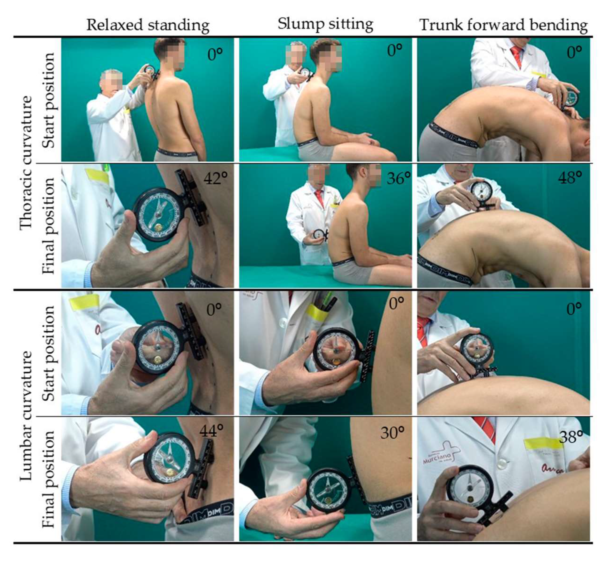 IJERPH Free Full-Text Sagittal Integral Morphotype of Competitive Amateur Athletes and Its Potential Relation with Recurrent Low Back Pain photo