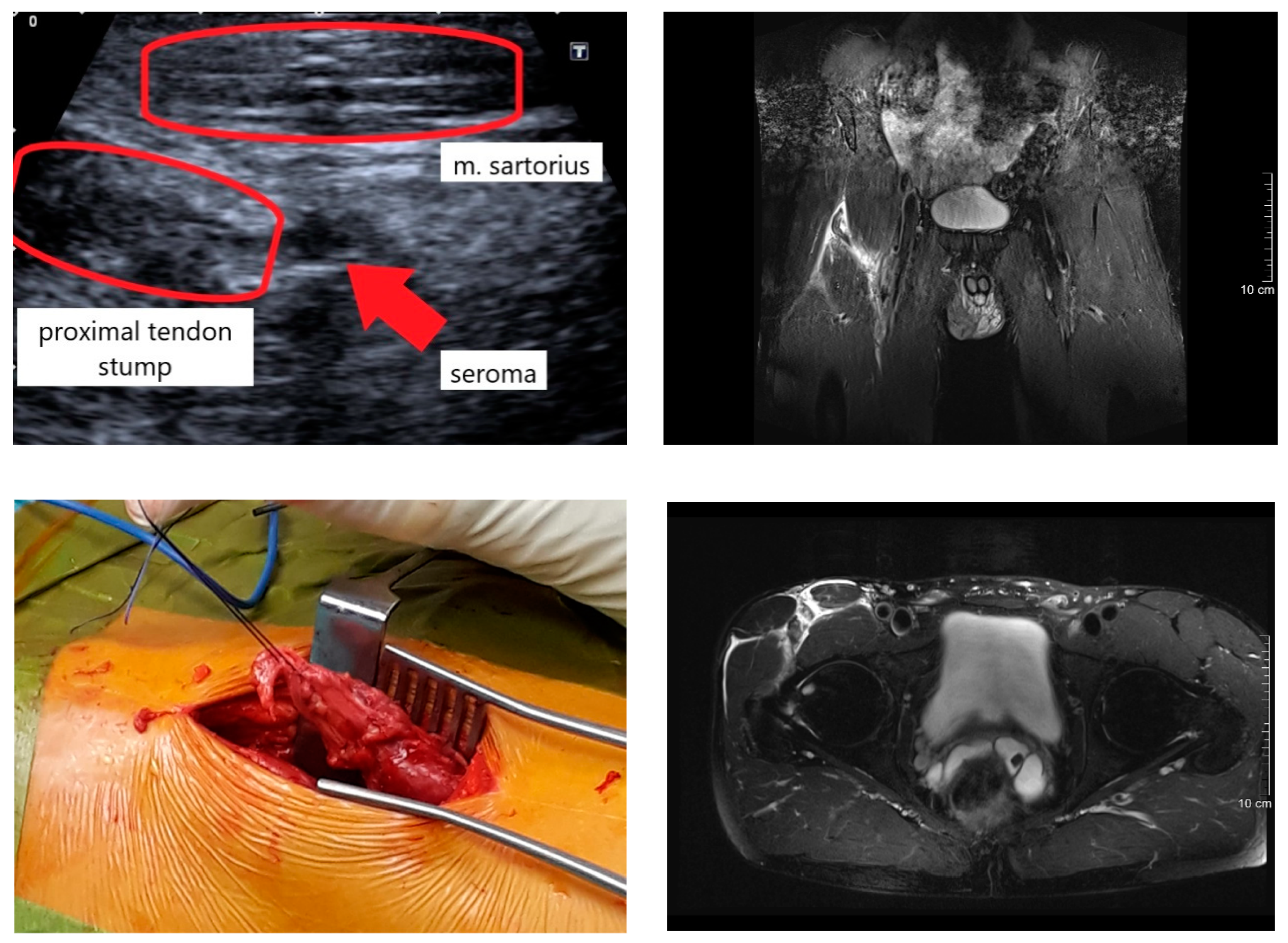 Ijerph 18 08727 g008b Ijerph 18 08727 g008b