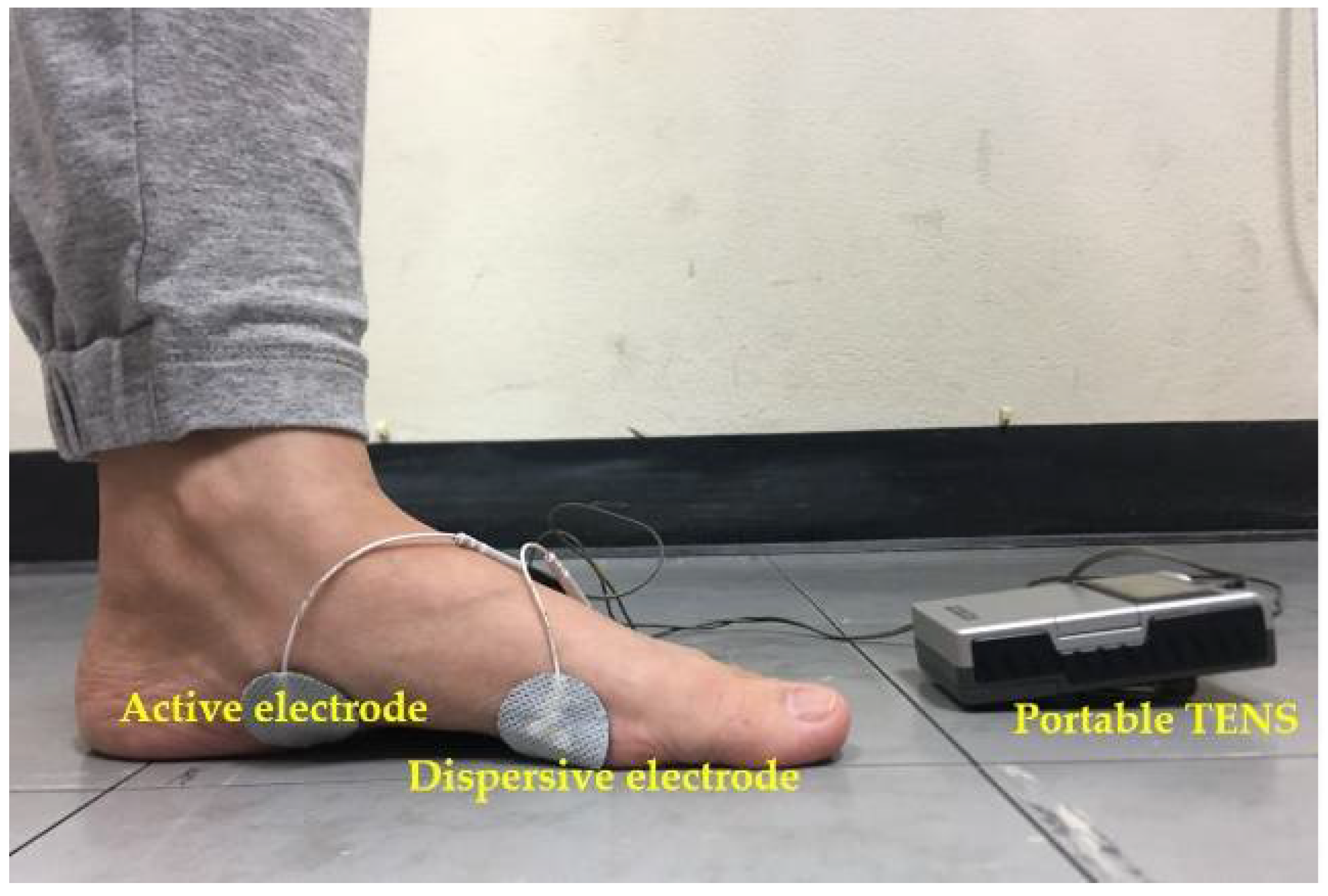 Neuromuscular Electrical Stimulation (NMES) for foot drop