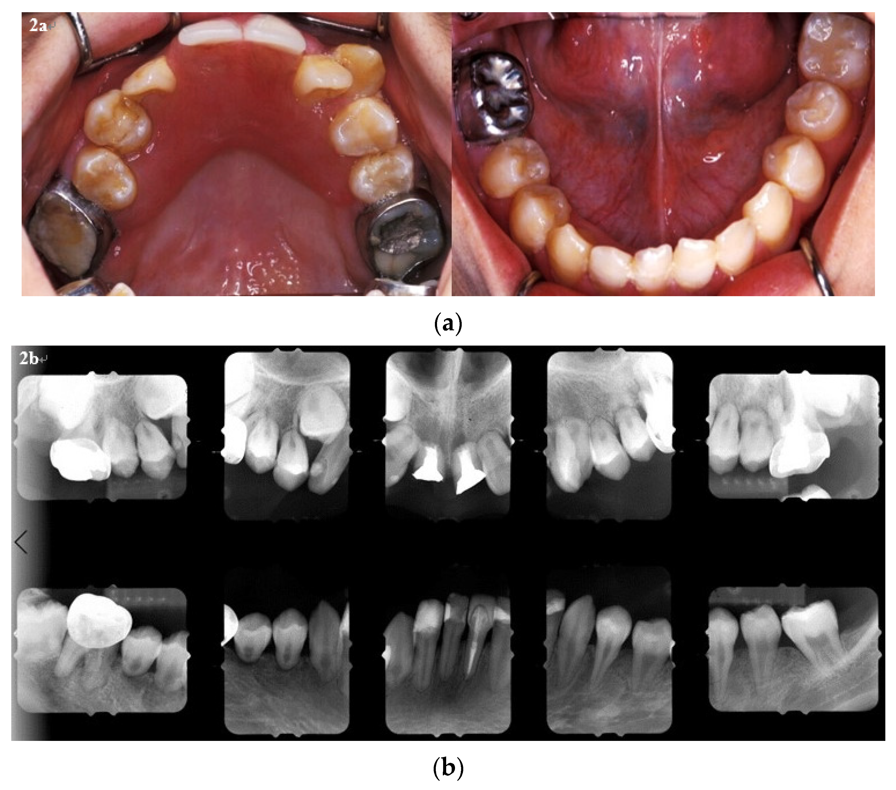 Ijerph 18 12158 g002 Ijerph 18 12158 g002