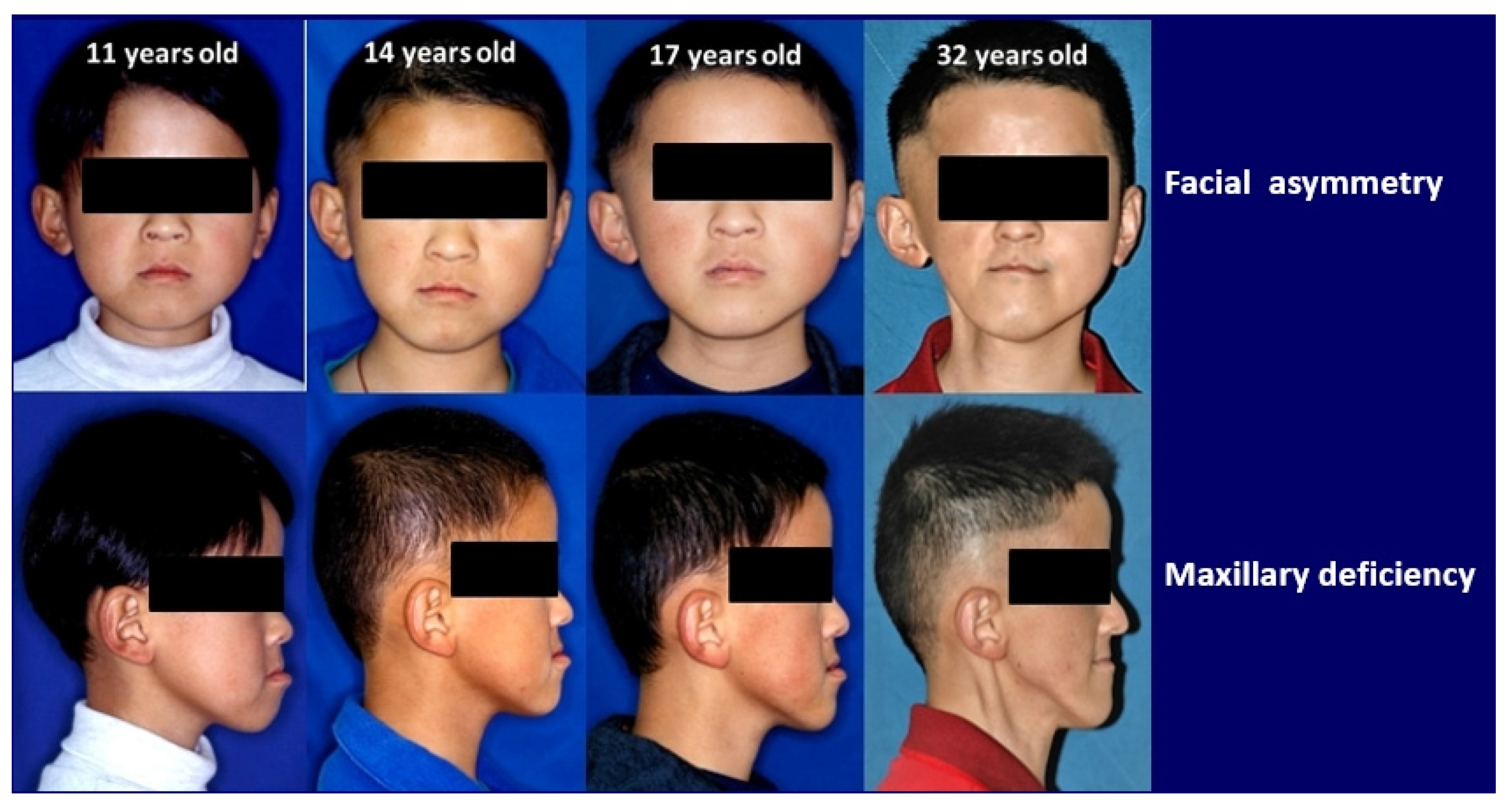 Ijerph 18 12158 g003 Ijerph 18 12158 g003