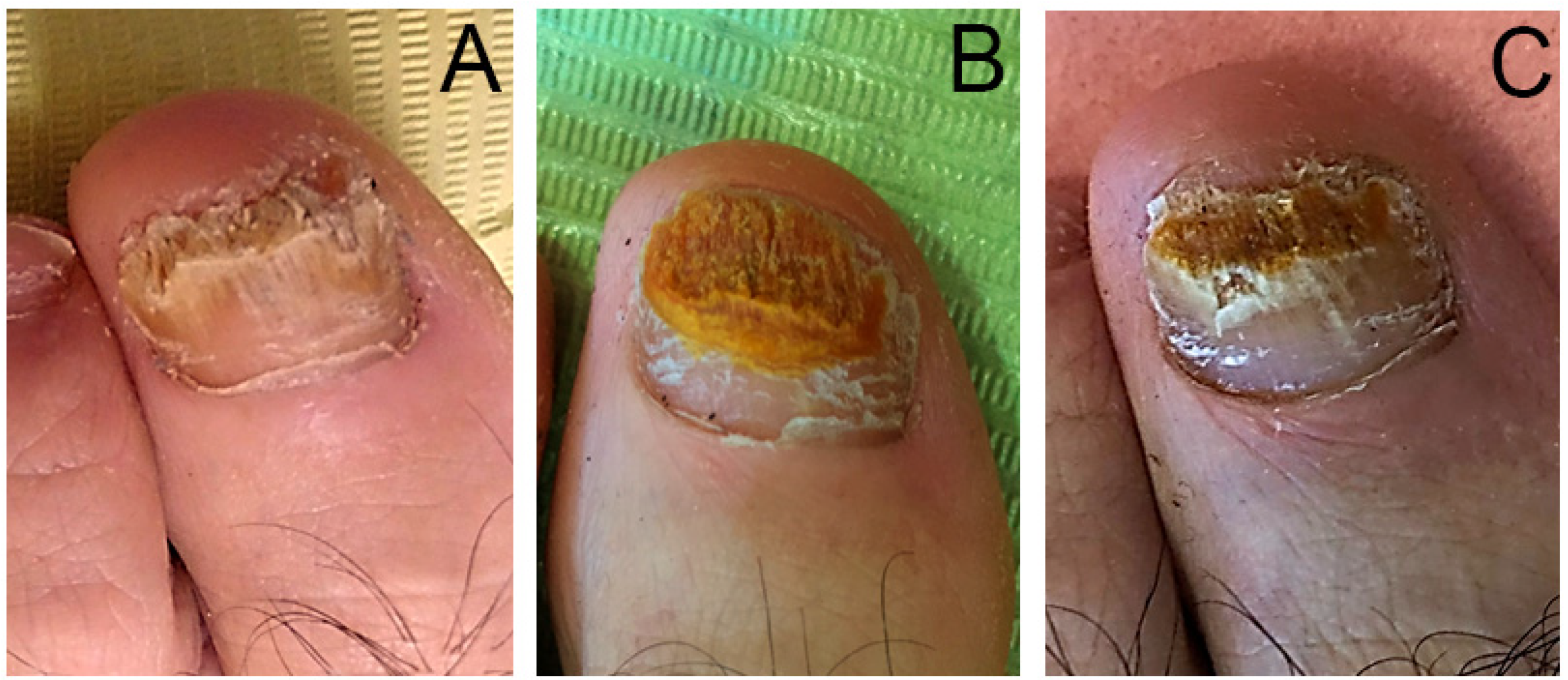 Management and treatment options for common foot conditions - The  Pharmaceutical Journal