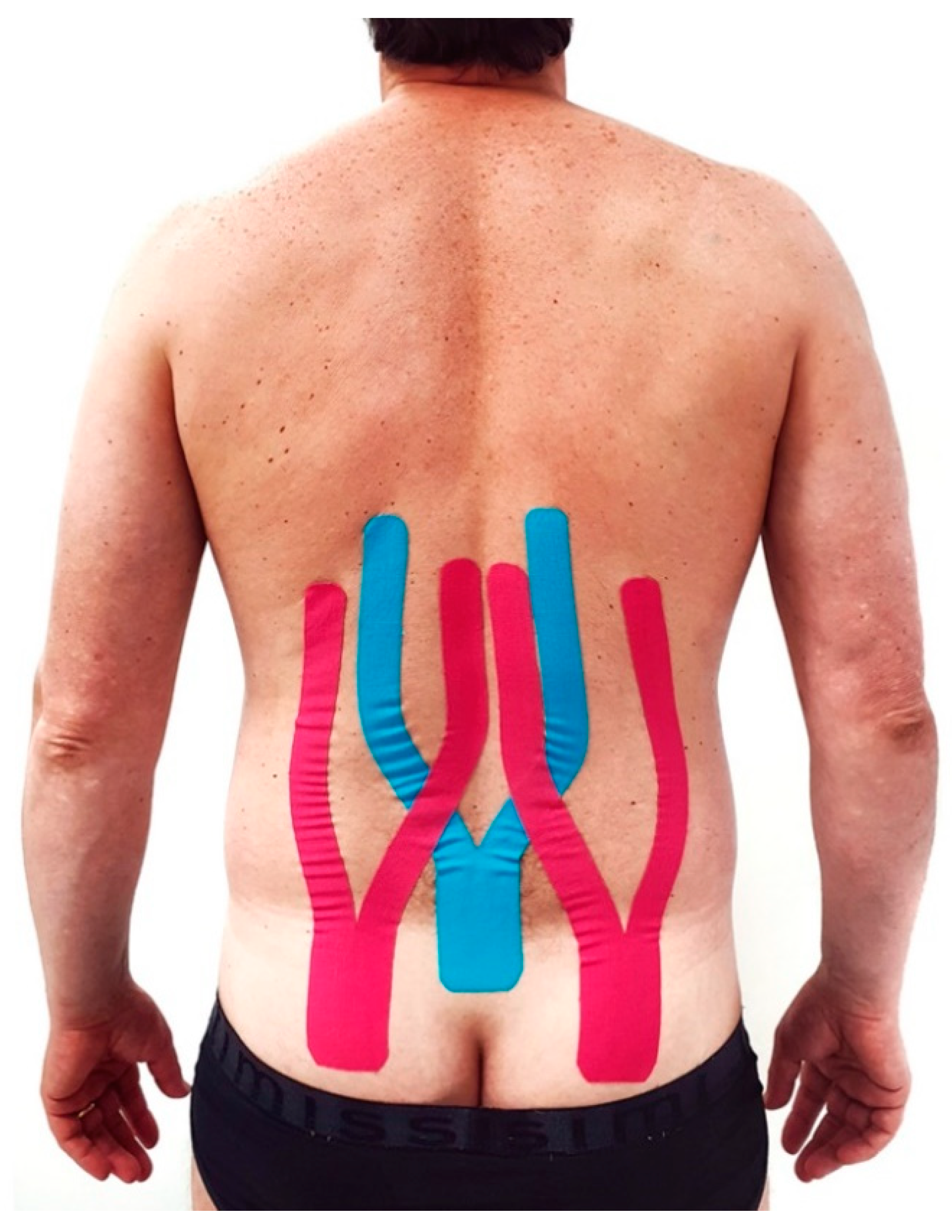 Kinesiology Taping for Lower Back, Lumbar Spine - How To K Tape