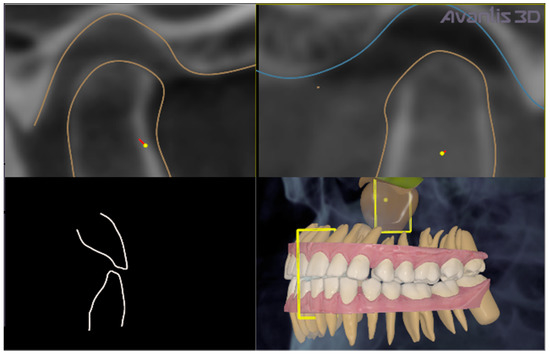 Restoring Smiles with Precision and Care - News - Spaulding Dental Co.