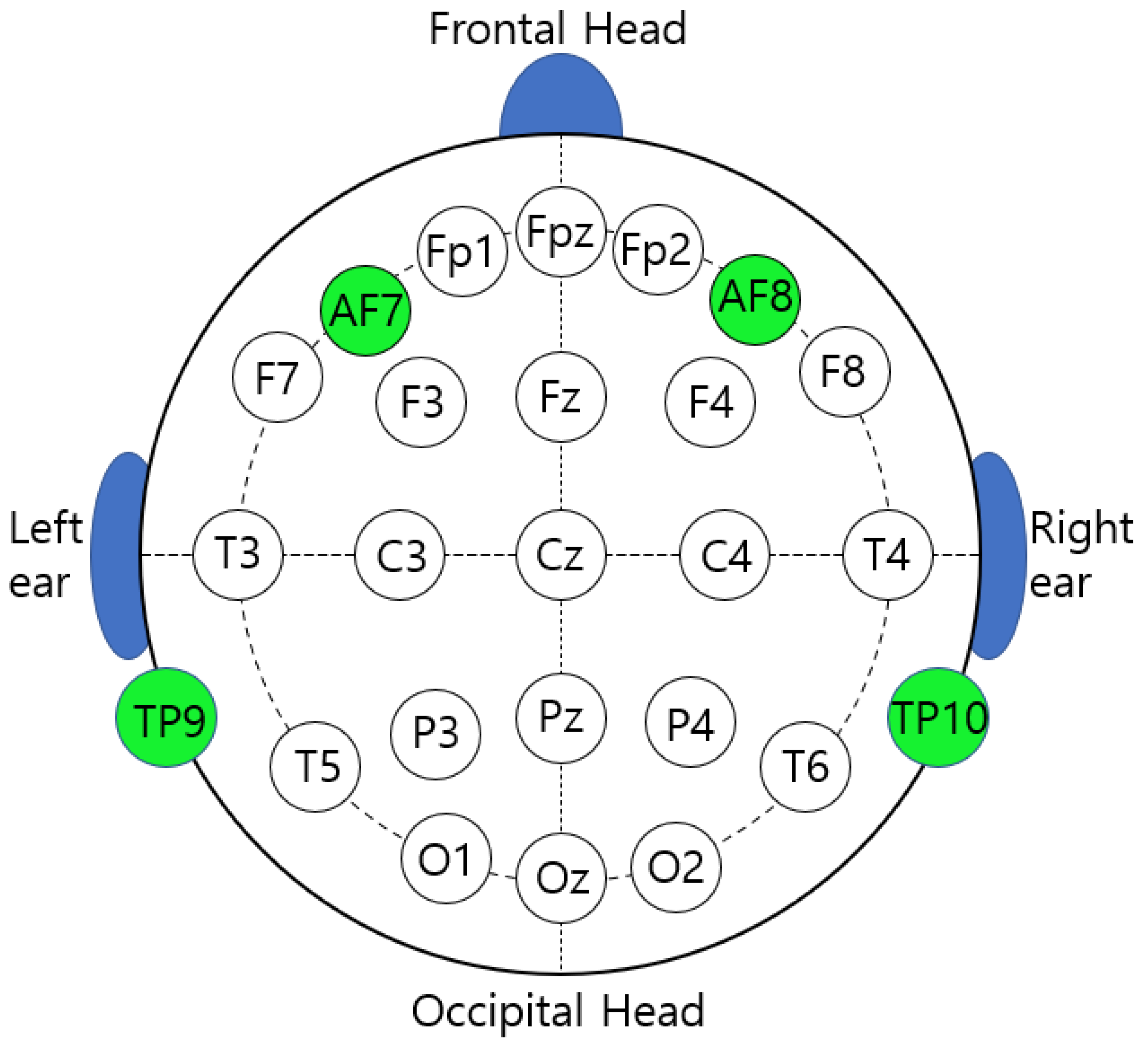 IJERPH | Free Full-Text | The Effect of Juingong Meditation on the ...