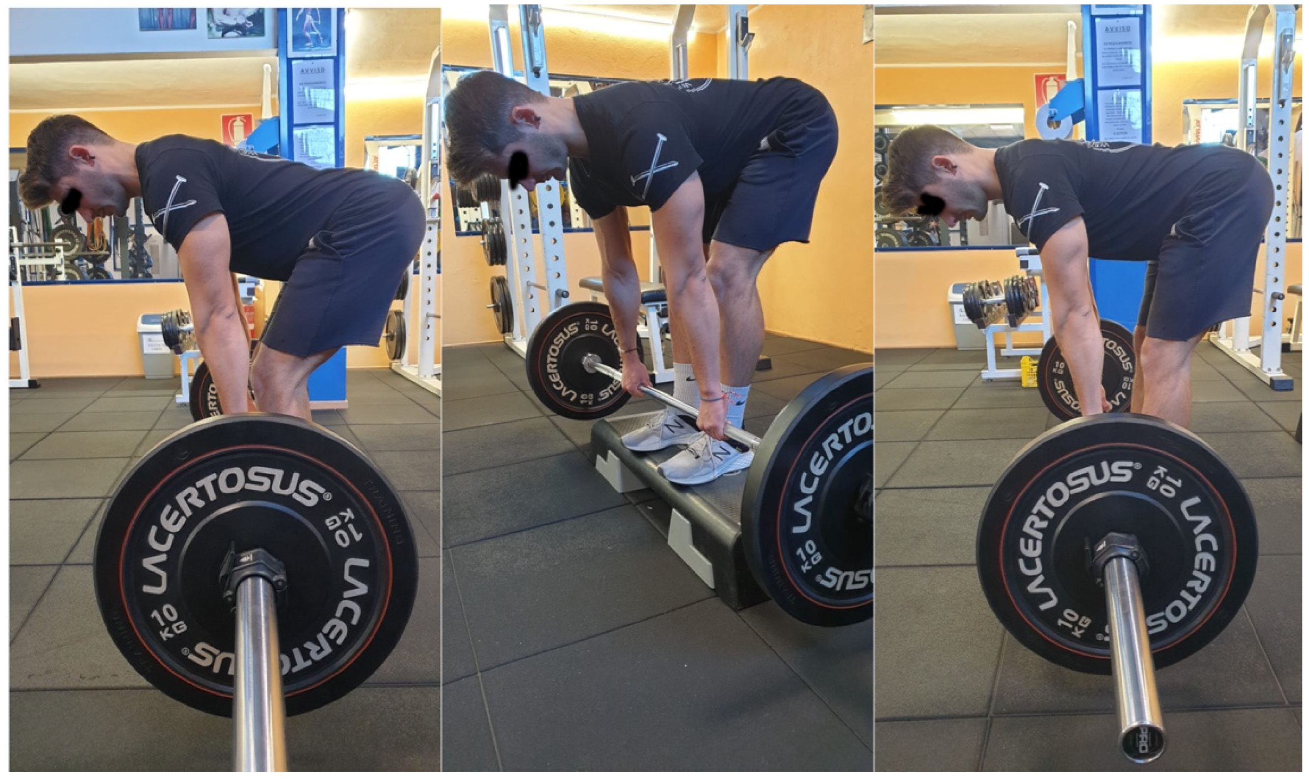 IJERPH | Free Full-Text | An Electromyographic Analysis of Romanian, Step- Romanian, and Stiff-Leg Deadlift: Implication for Resistance Training