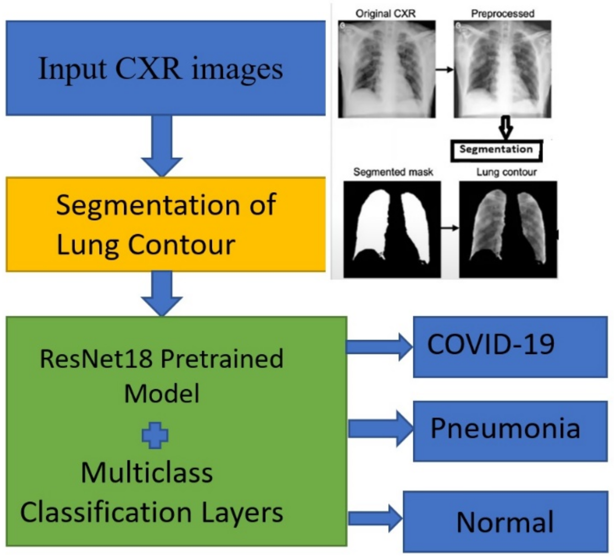 Deep Learning Model For Detecting Covid On Chest X Ray Using Matlab