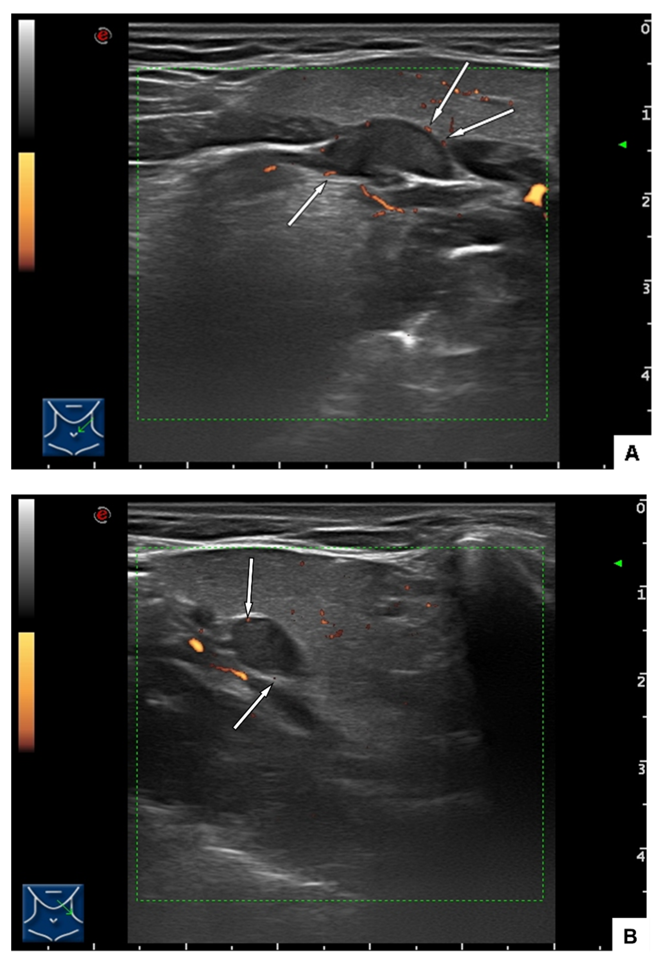 Ijerph 19 02690 g003 Ijerph 19 02690 g003