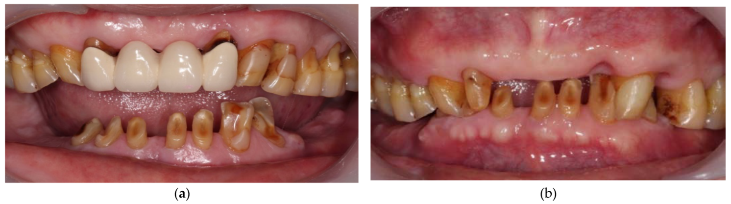 Ijerph 19 03021 g003