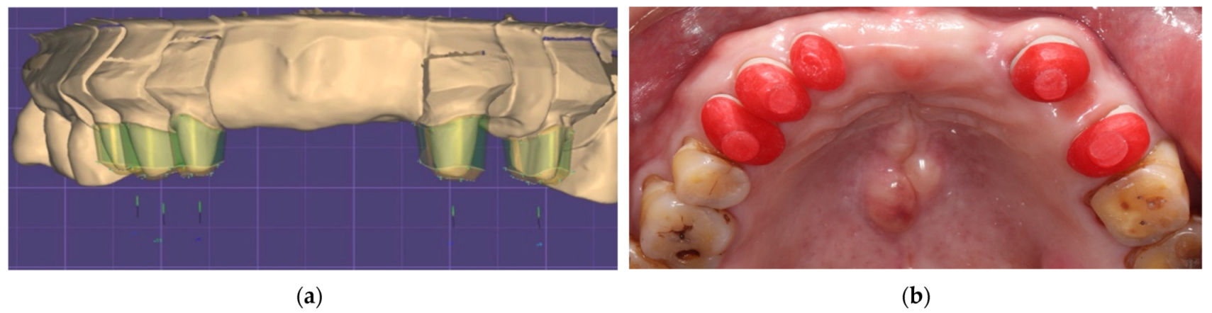 Ijerph 19 03021 g004