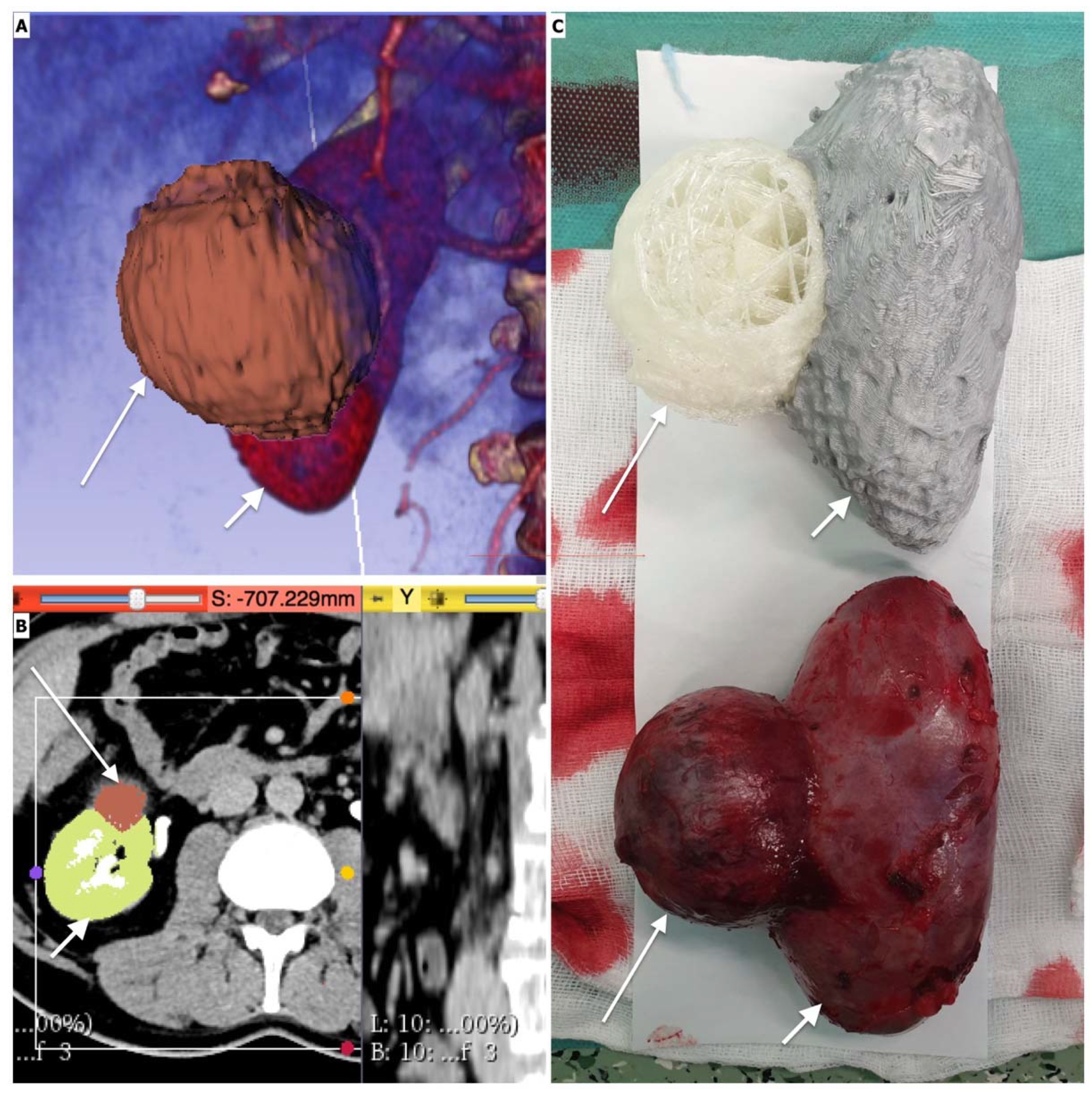 Ijerph Free Full Text The Role Of 3d Printing In Planning Complex Medical Procedures And Training Of Medical Professionals Mdash Cross Sectional Multispecialty Review Html