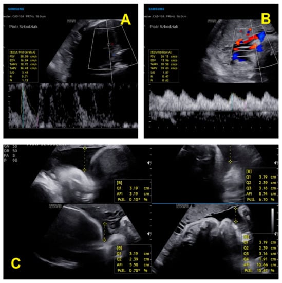 IJERPH | Free Full-Text | A Successful New Case of Twin Pregnancy in a ...