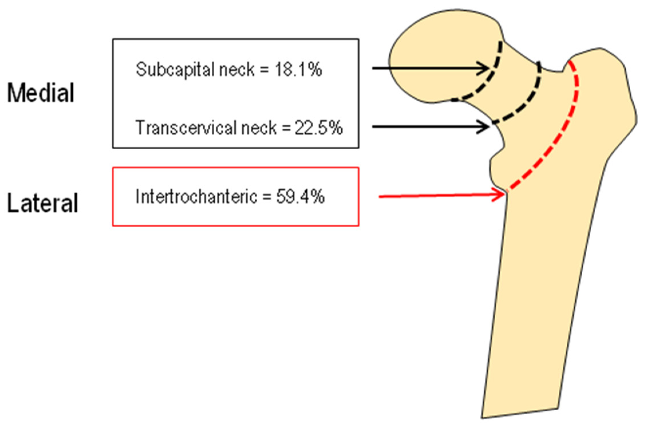 IJERPH | Free Full-Text | The Phenotype of Bone Turnover in Patients ...