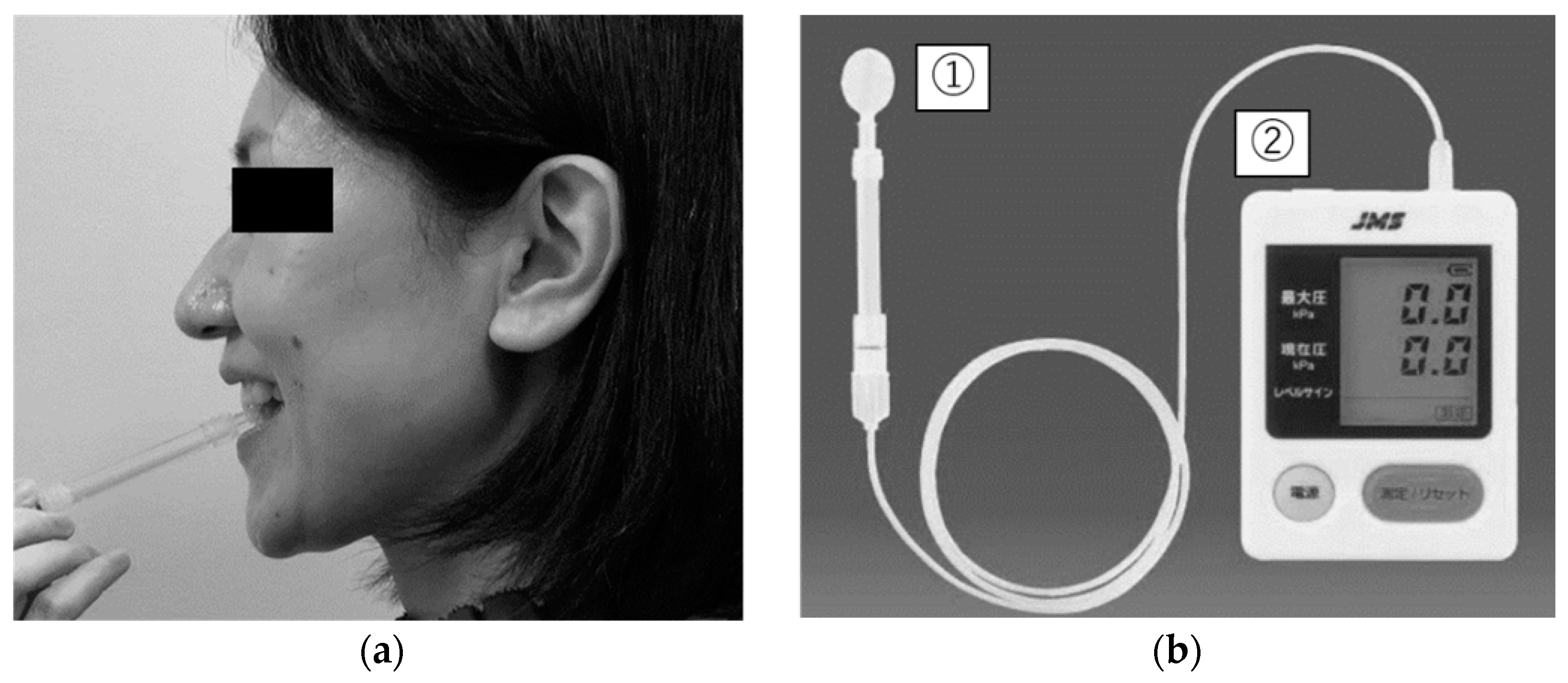 IJERPH | Free Full-Text | Association between Tongue Pressure and
