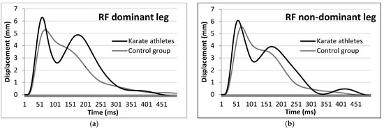 contraction timing