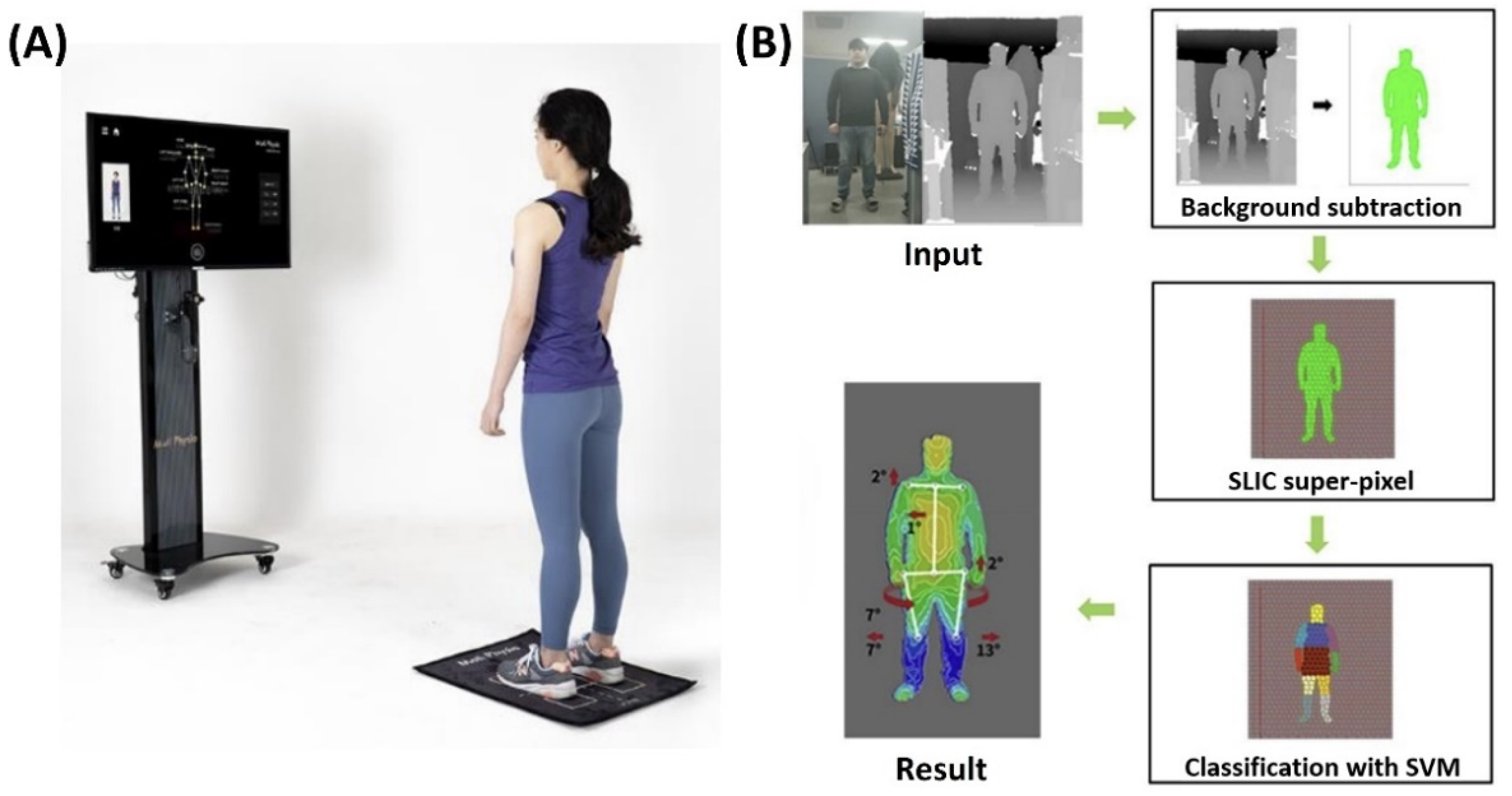 3D Body Scanners used as Postural Assessment Tool