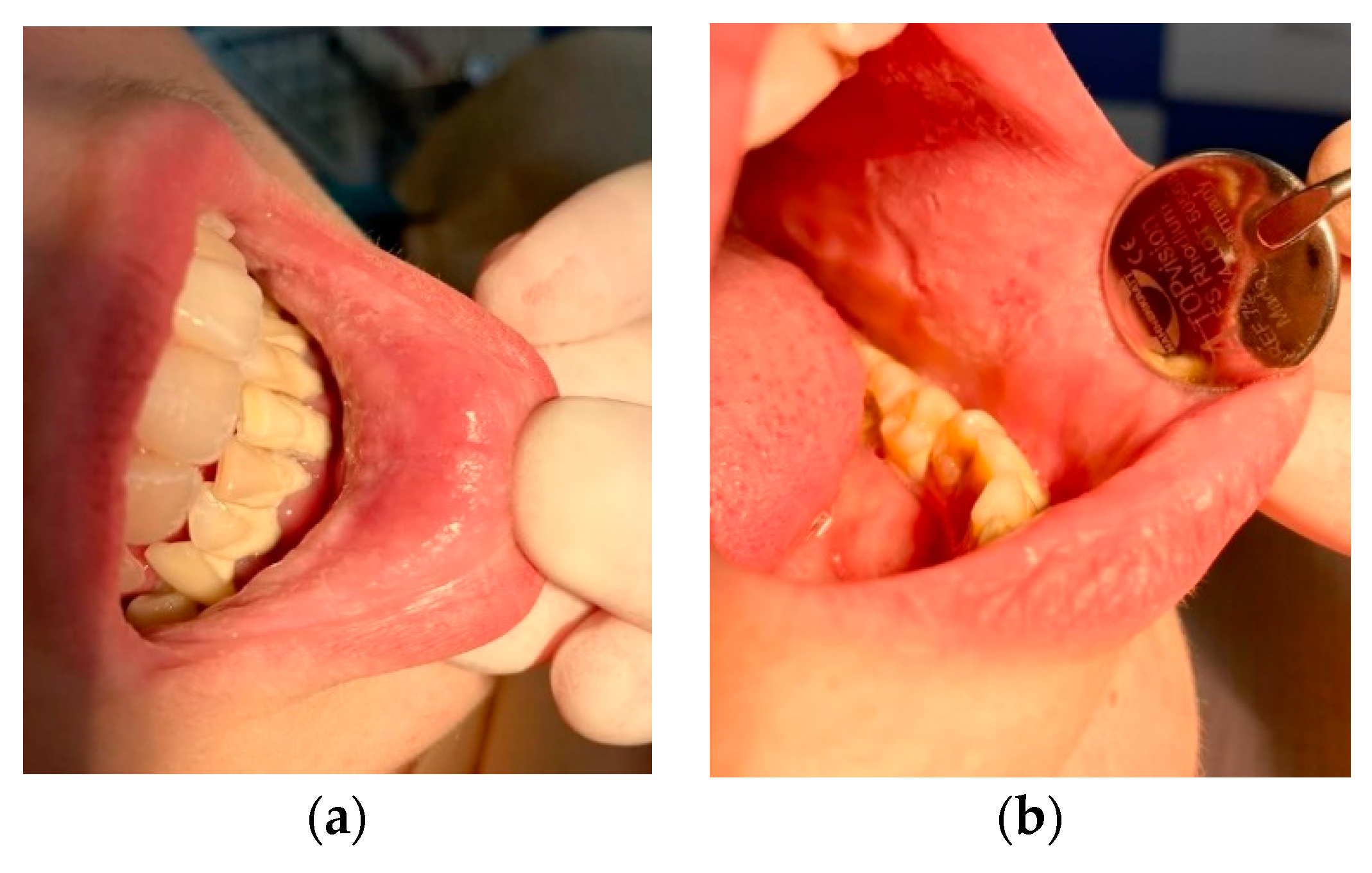 Ijerph 19 15564 g003 Ijerph 19 15564 g003