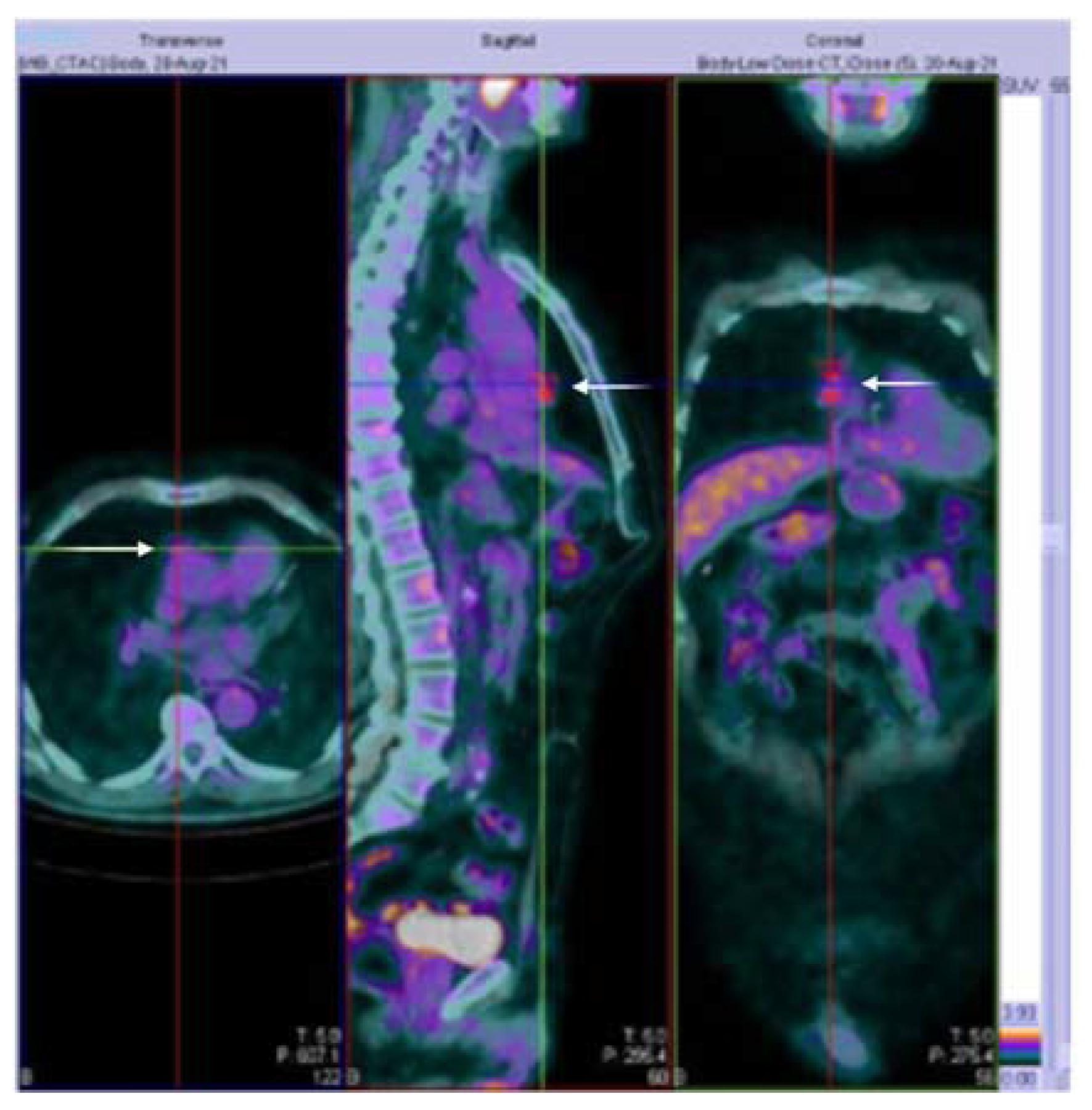 Ijerph 20 00467 g002 Ijerph 20 00467 g002