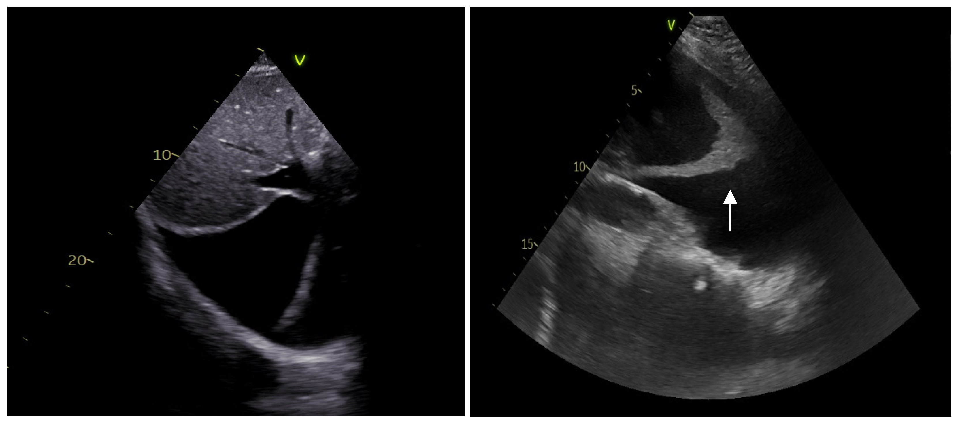 IJERPH | Free Full-Text | The Incremental Role Of Multiorgan Point-of ...