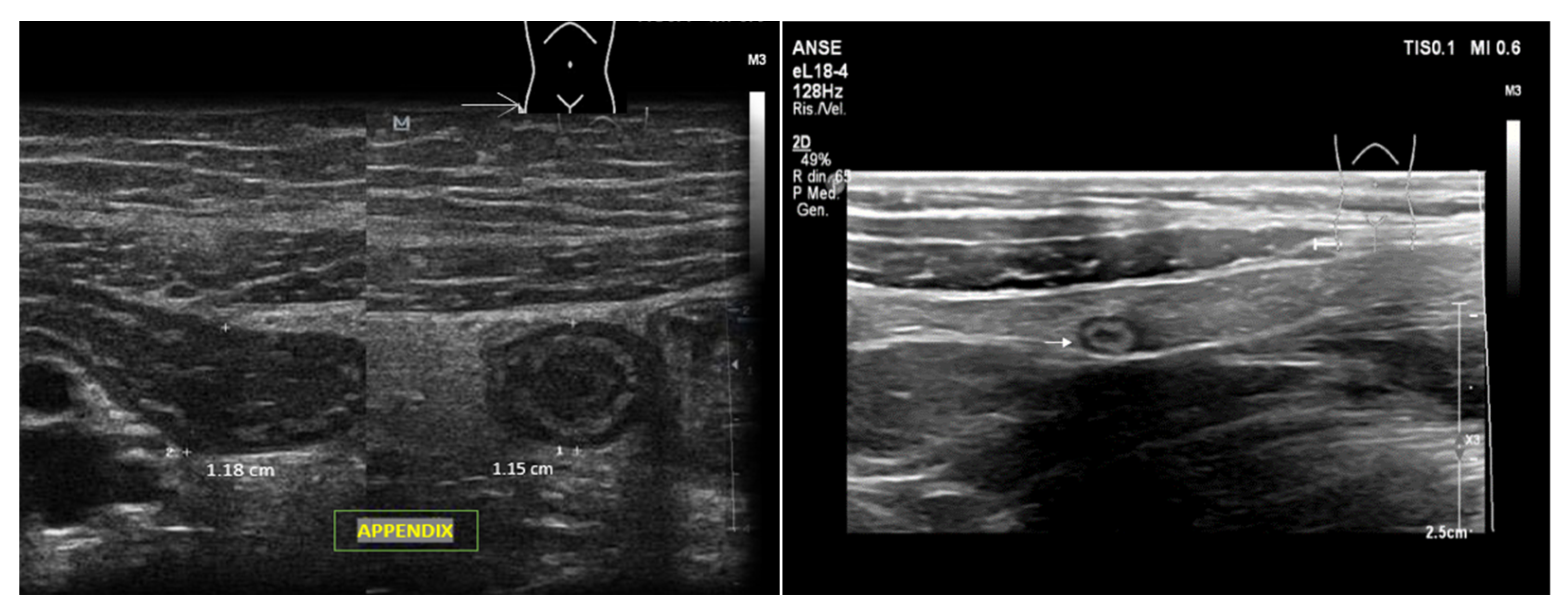 Ijerph 20 02088 g010 Ijerph 20 02088 g010