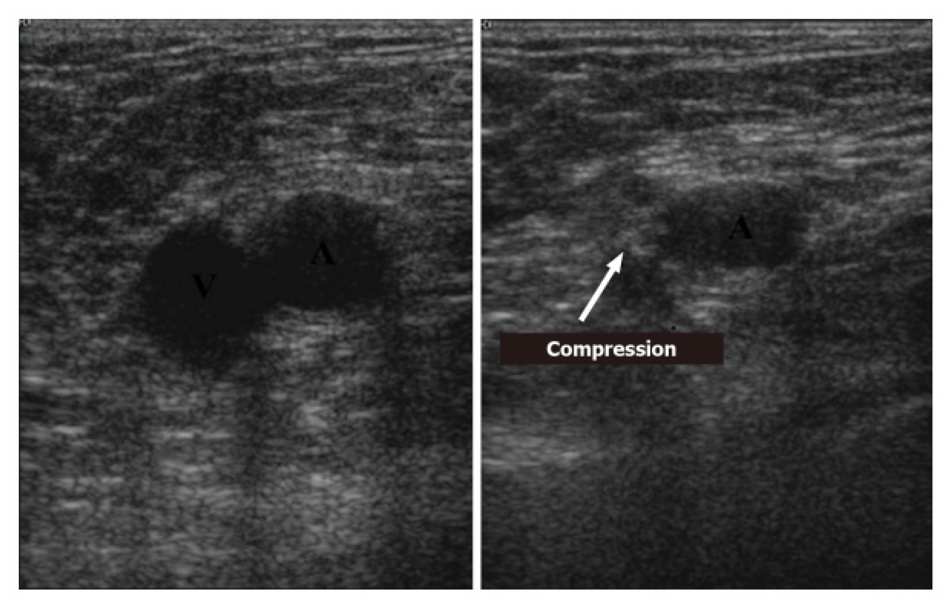 Ijerph 20 02088 g013 Ijerph 20 02088 g013