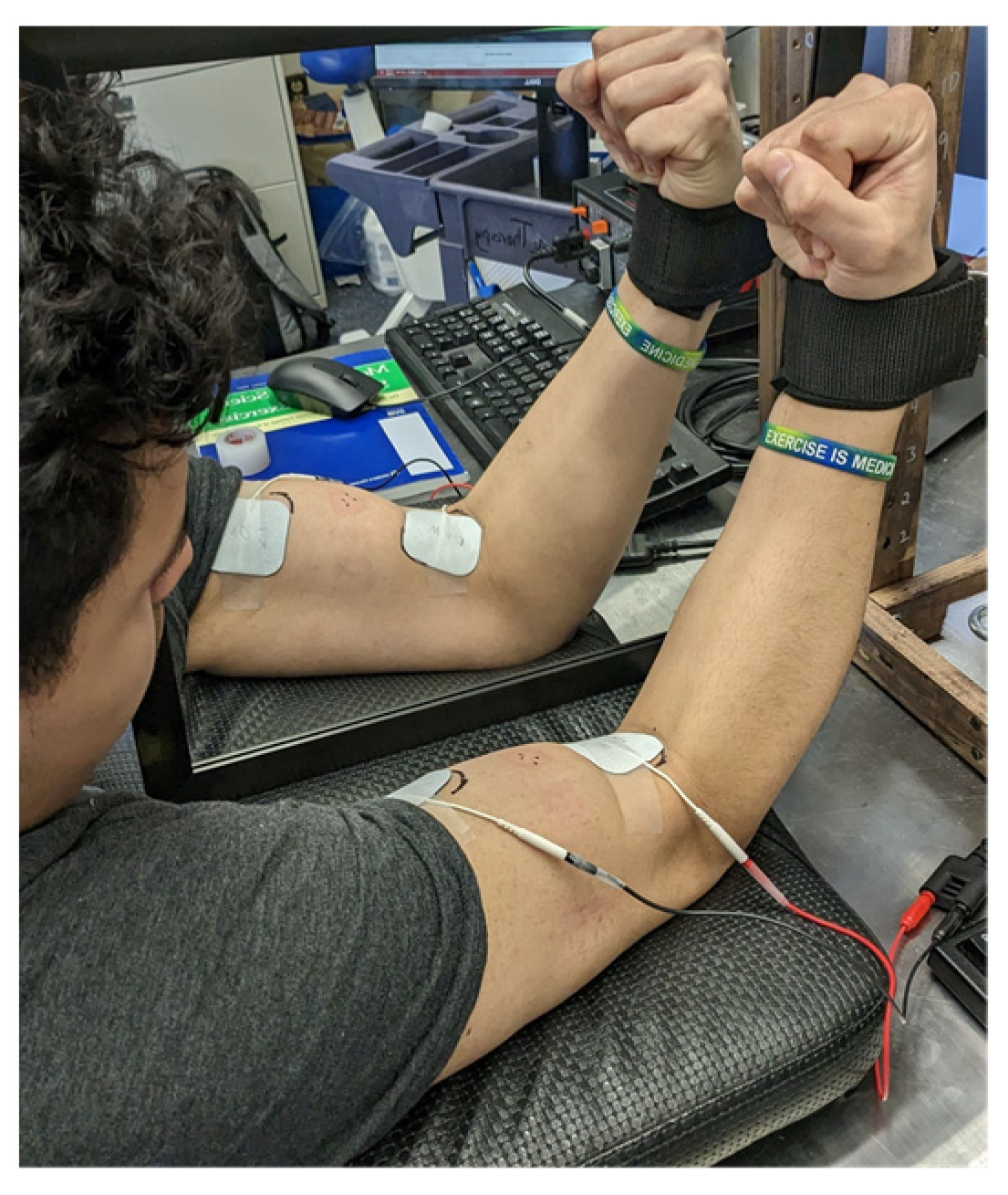 PDF] NEUROMUSCULAR ELECTRICAL STIMULATION OF MEDIUM AND LOW FREQUENCY ON  THE QUADRICEPS FEMORIS