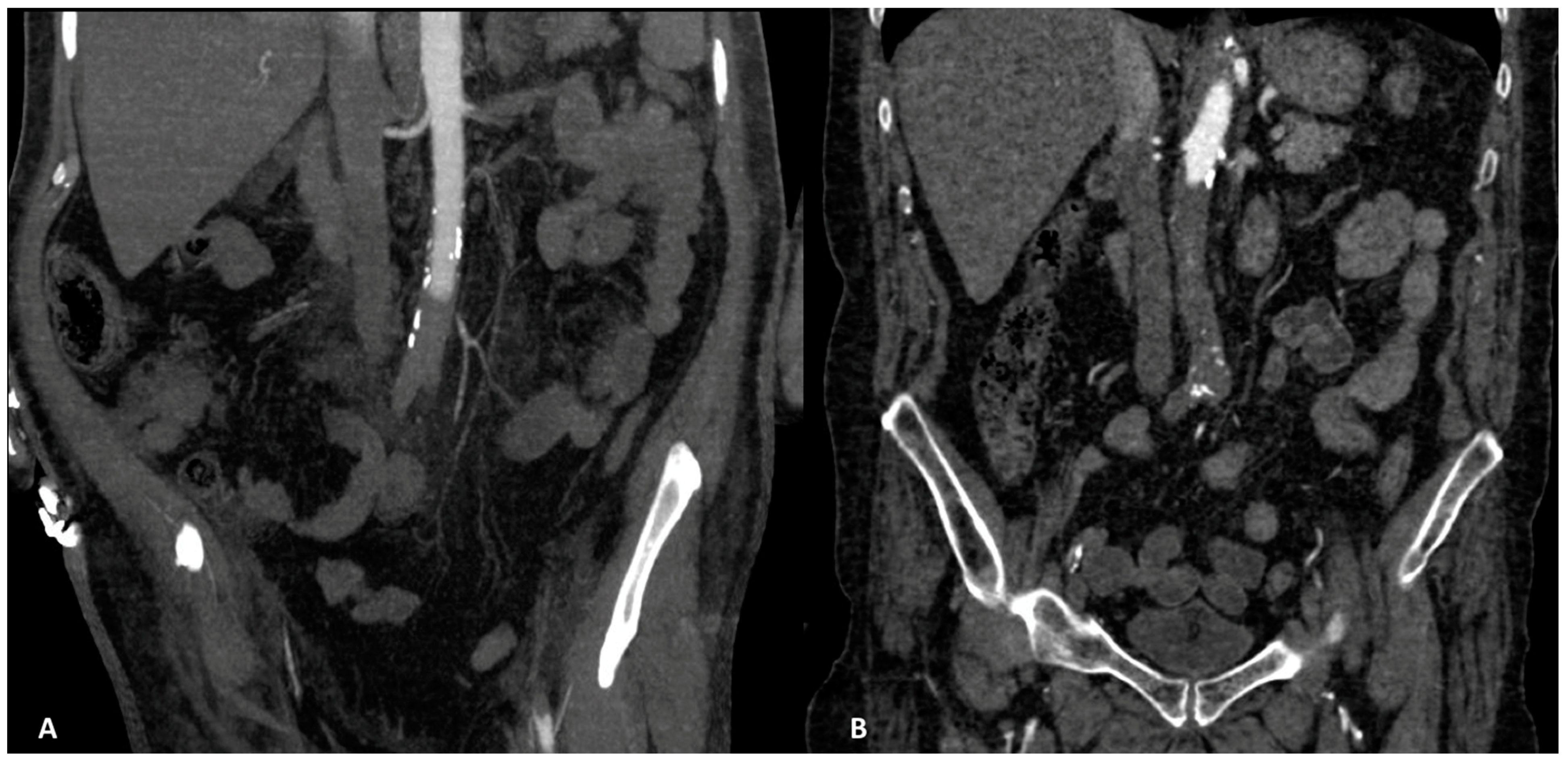 Ijerph 20 03868 g002 Ijerph 20 03868 g002