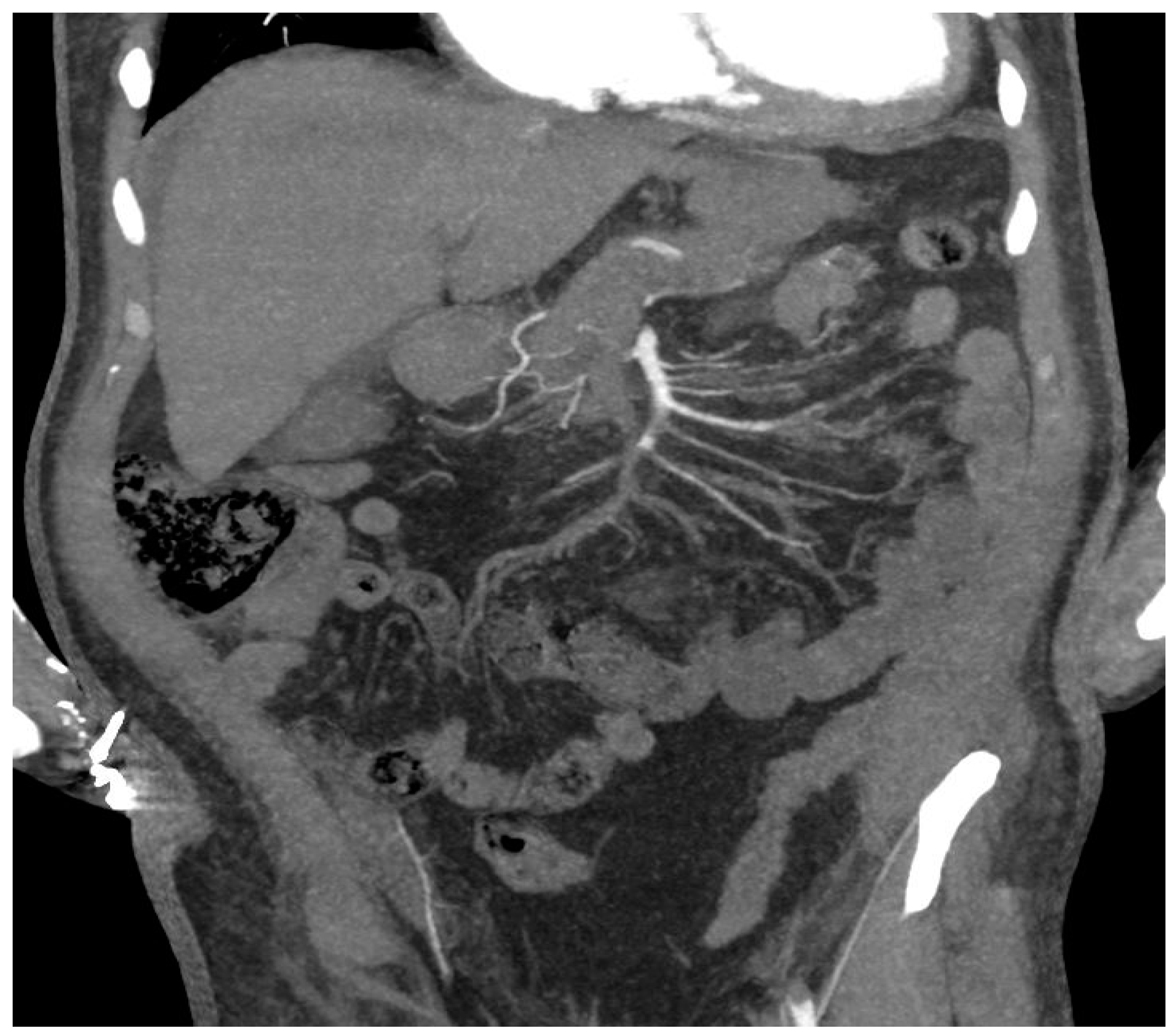 Ijerph 20 03868 g005 Ijerph 20 03868 g005