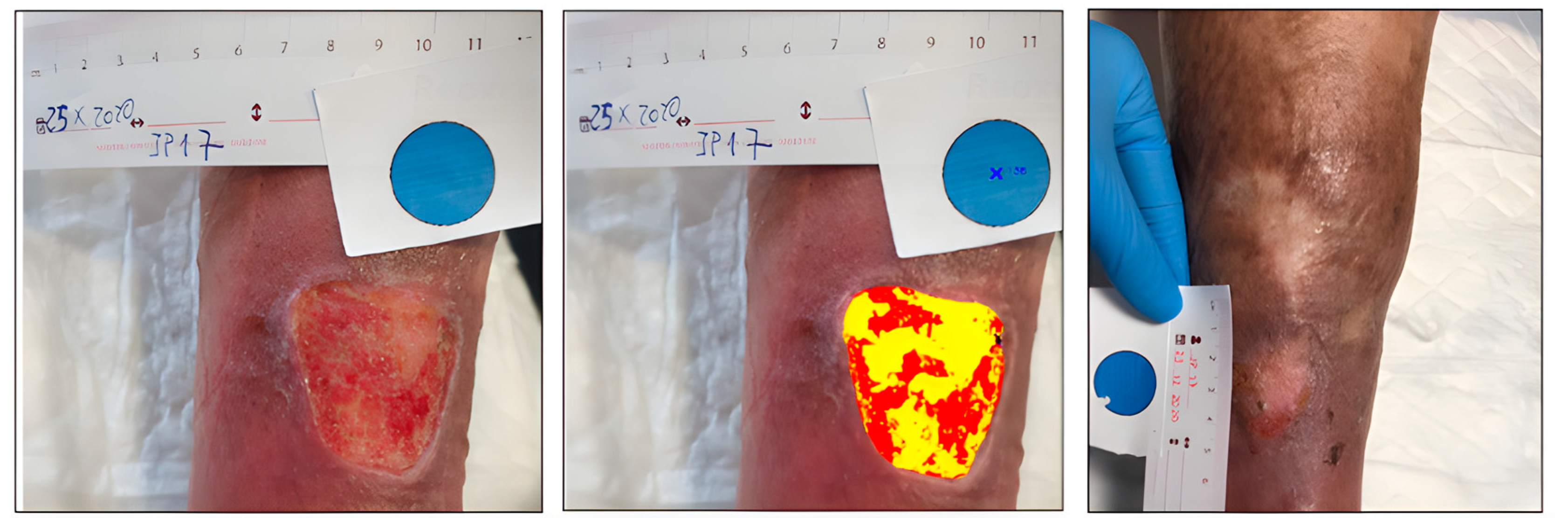 Ijerph 20 04147 g005 Ijerph 20 04147 g005