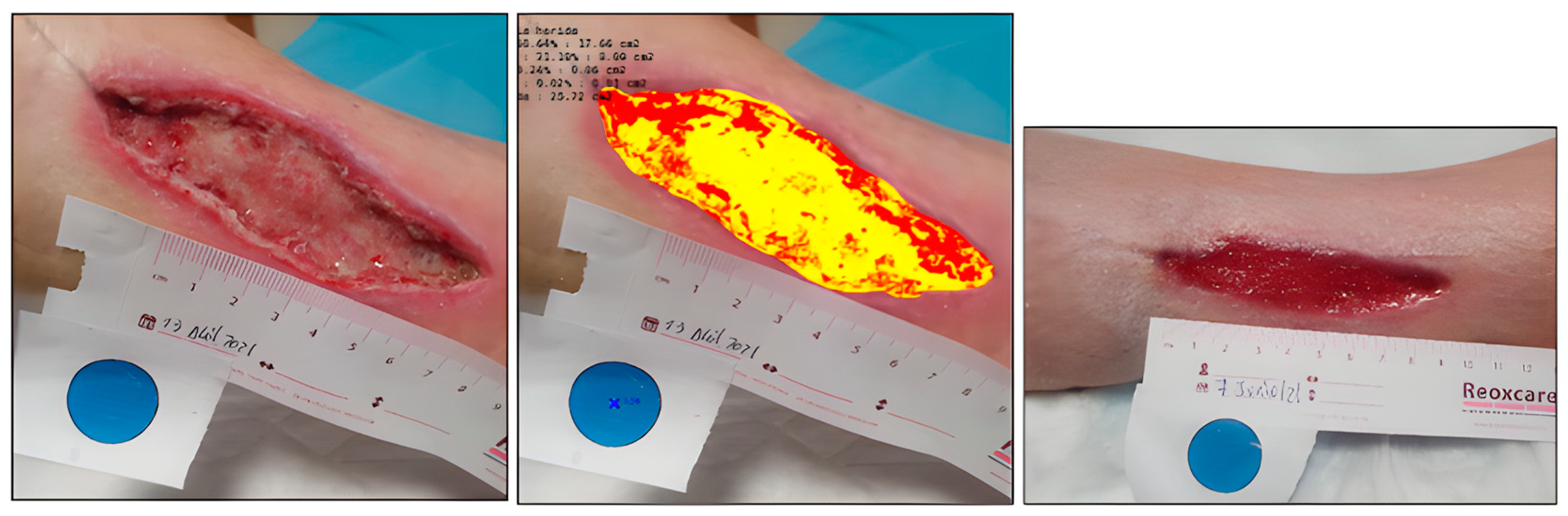 Ijerph 20 04147 g011 Ijerph 20 04147 g011