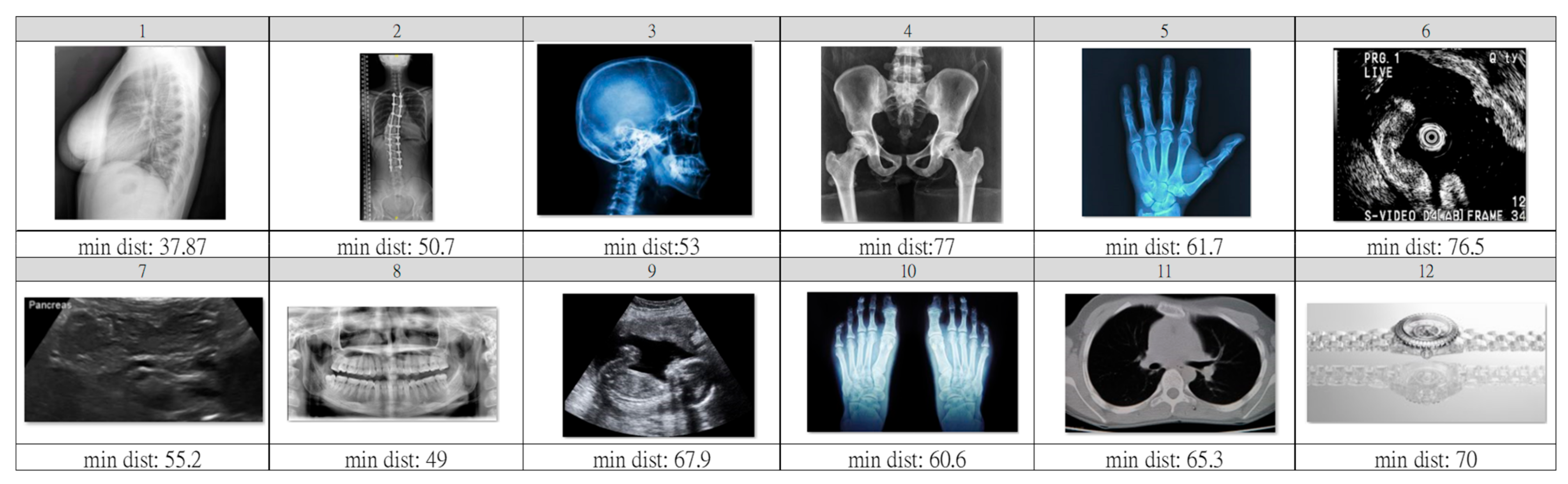 Ijerph 20 04330 g007 Ijerph 20 04330 g007