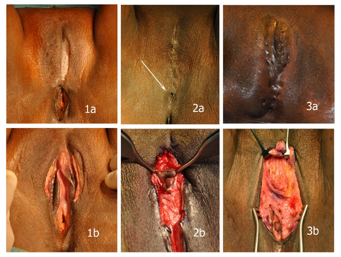 Ijerph 20 04439 g001 Ijerph 20 04439 g001