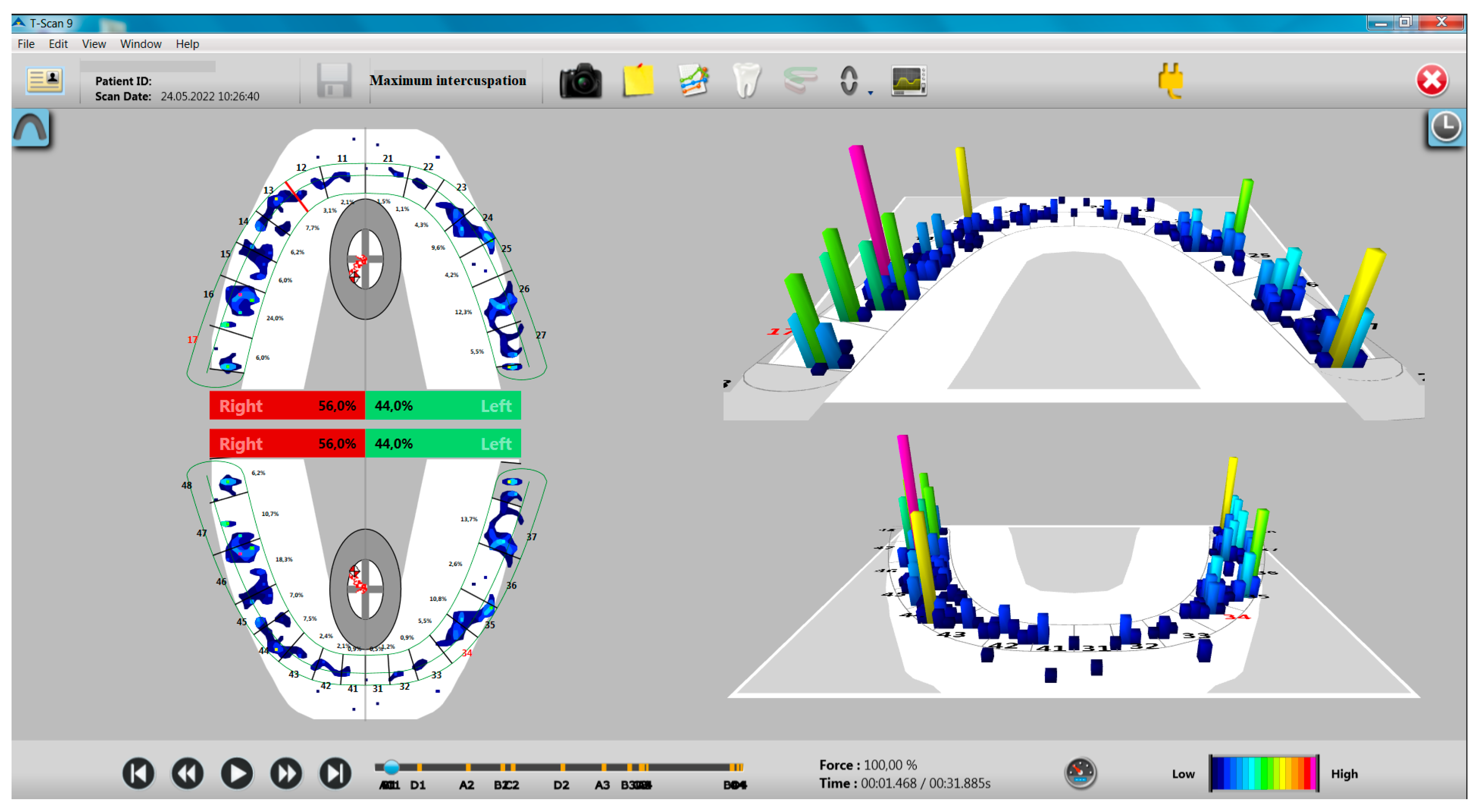 IJERPH Free FullText Aspects of Dental Occlusion Assessed with the