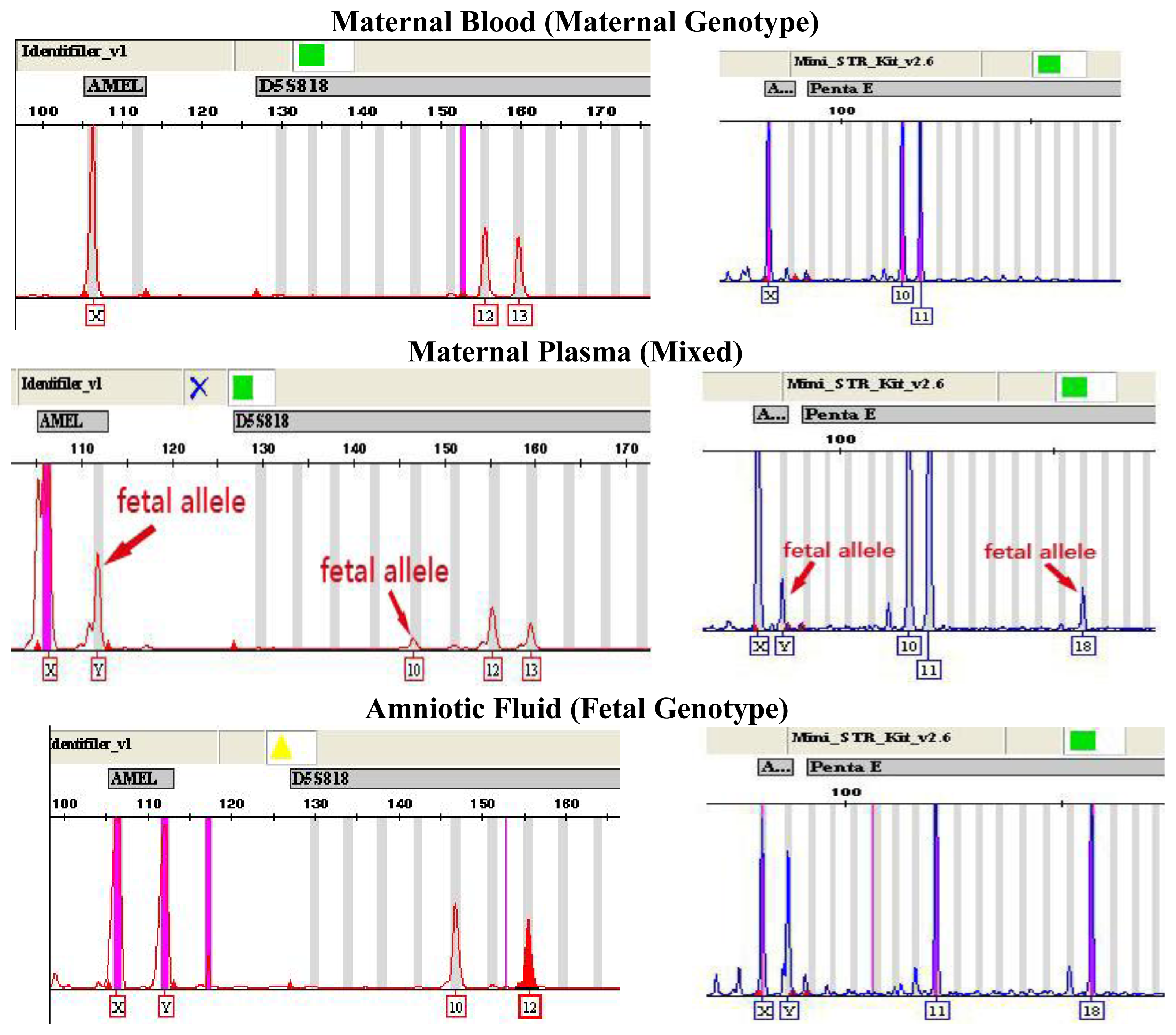 IJMS | Free Full-Text | Multiplex PCR for 17 Y-Chromosome Specific Short  Tandem Repeats (STR) to Enhance the Reliability of Fetal Sex Determination  in Maternal Plasma