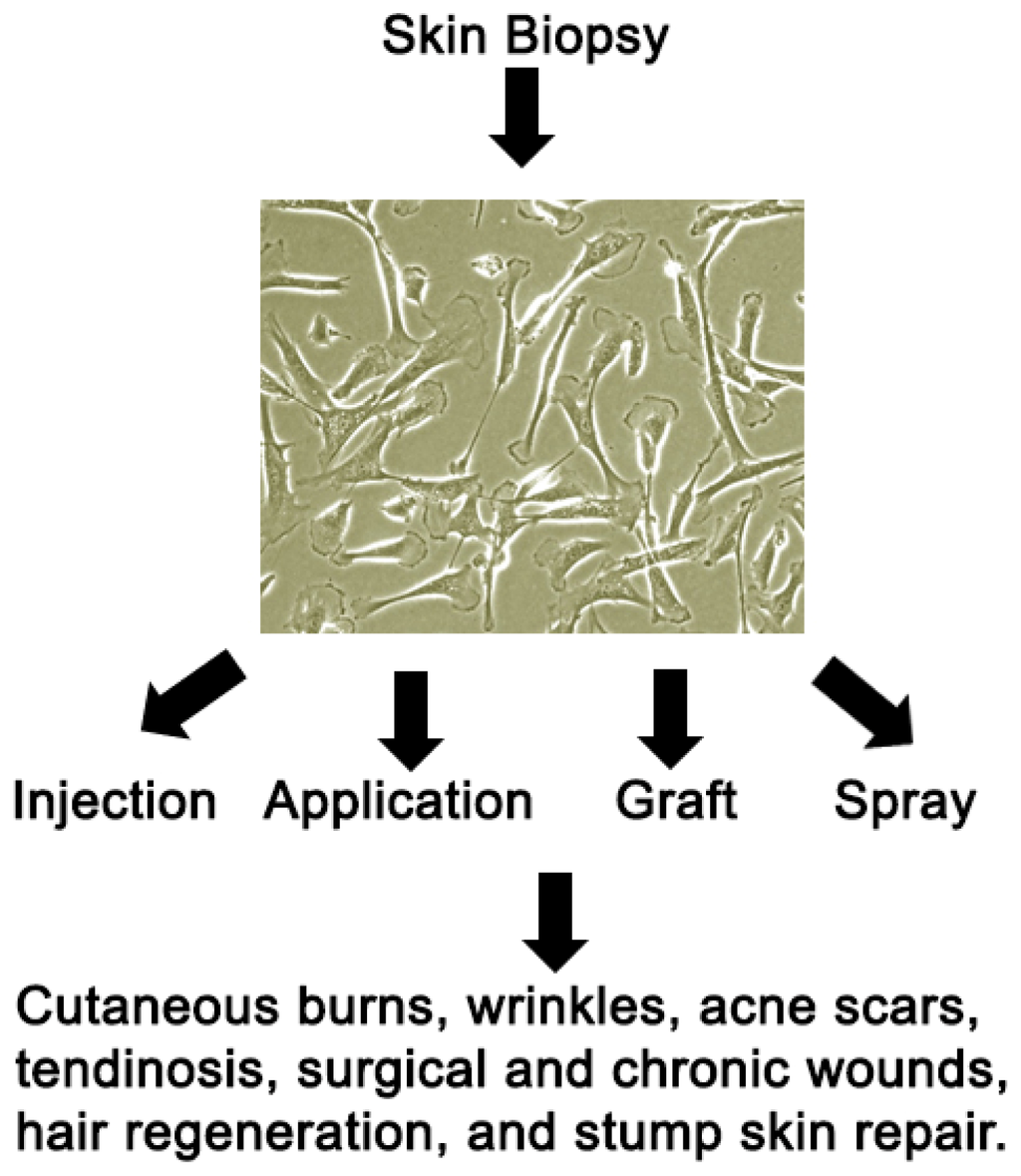 IJMS | Free Full-Text | Alteration of Skin Properties with Autologous  Dermal Fibroblasts | HTML
