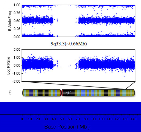 Ijms Free Full Text A Microdeletion Of Chromosome 9q33 3 Encompasses The Entire Lmx1b Gene In A Chinese Family With Nail Patella Syndrome