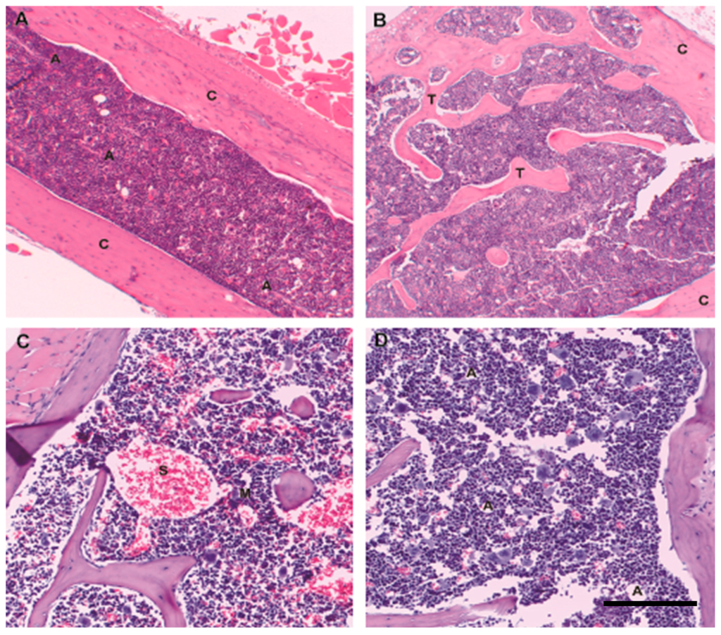 IJMS | Free Full-Text | Beyond The Niche: Myelodysplastic Syndrome ...