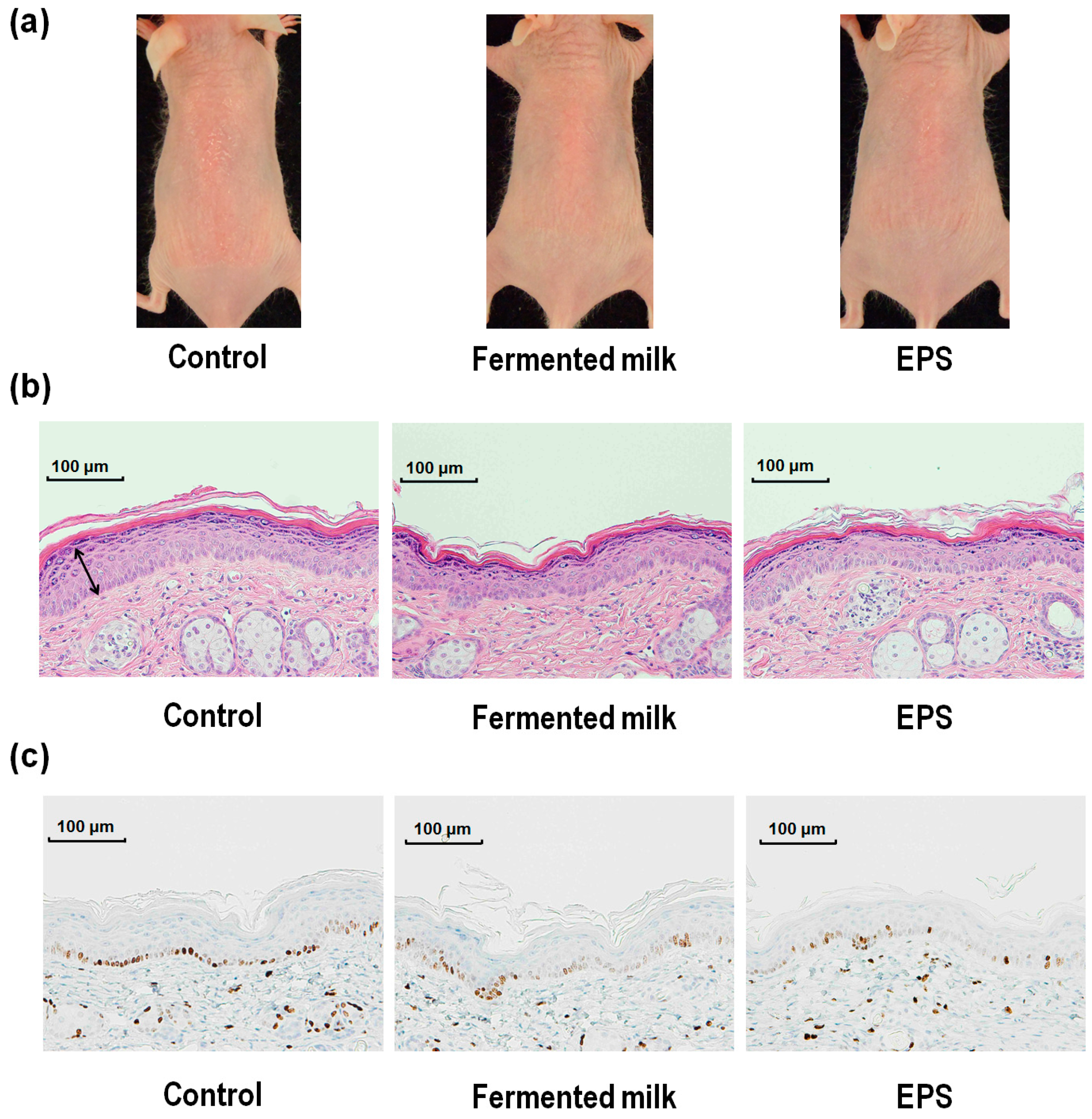 IJMS | Free Full-Text | Exopolysaccharides Isolated from Milk Fermented  with Lactic Acid Bacteria Prevent Ultraviolet-Induced Skin Damage in  Hairless Mice | HTML