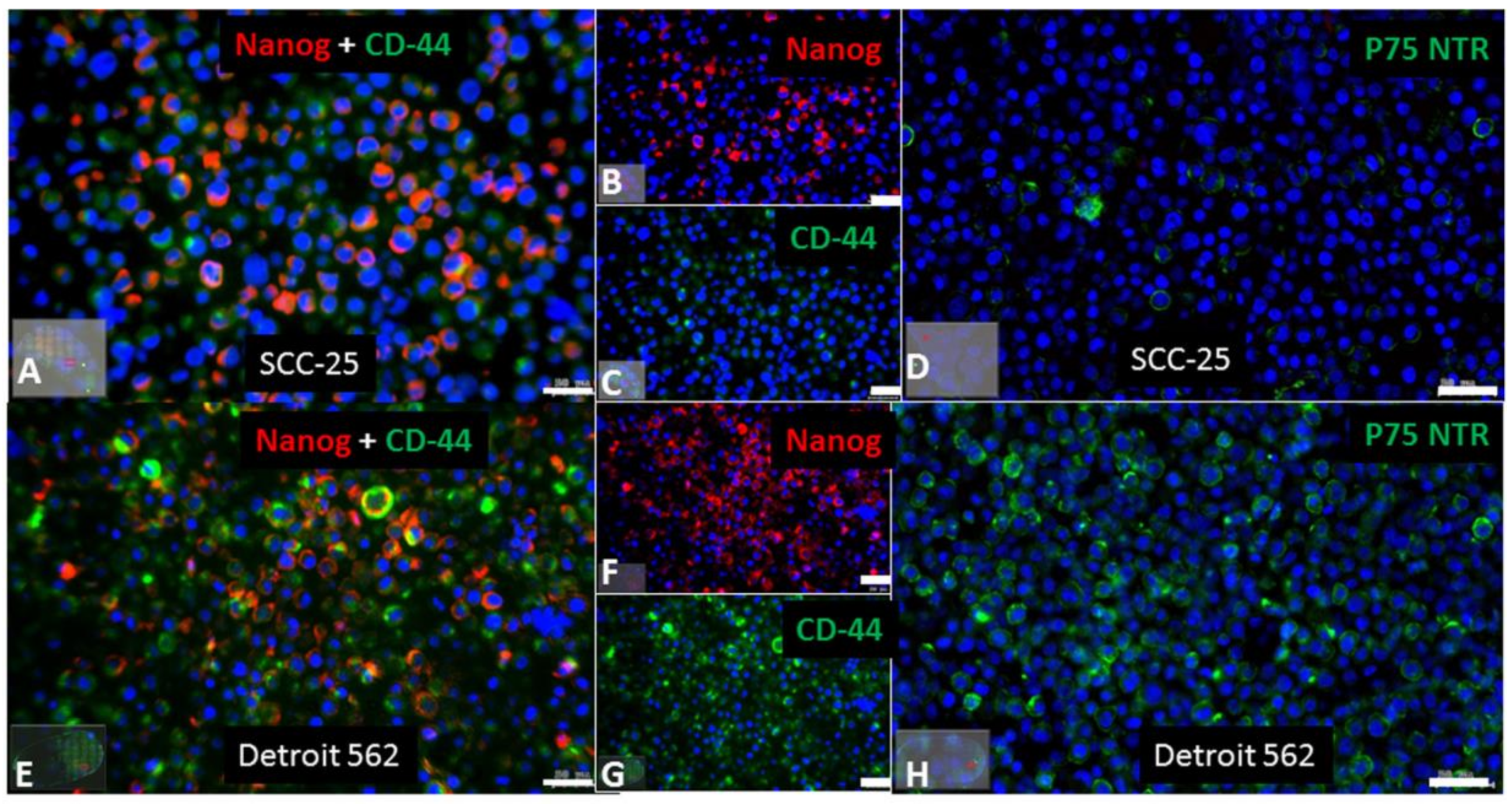 IJMS | Free Full-Text | Photodynamic Effect of Methylene Blue and Low Level  Laser Radiation in Head and Neck Squamous Cell Carcinoma Cell Lines | HTML