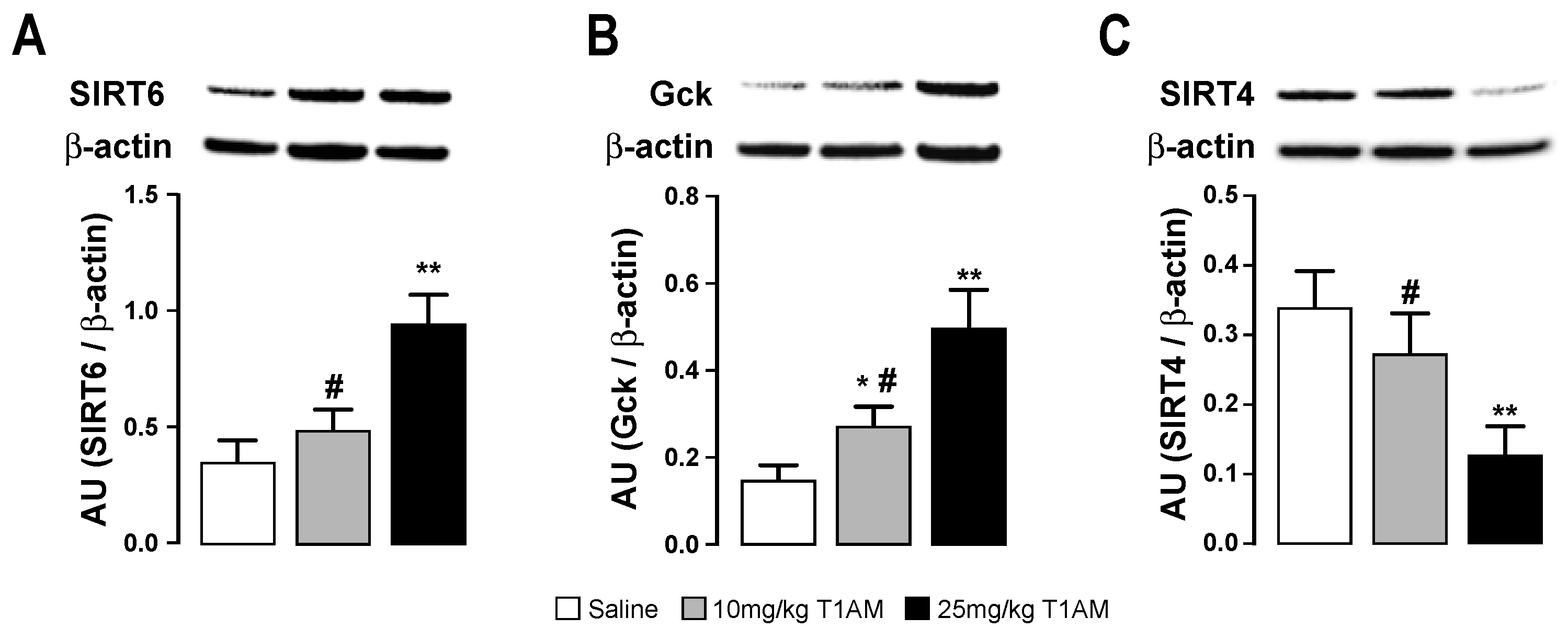 Ijms Free Full Text Metabolic Reprogramming By 3 Iodothyronamine T1am A New Perspective To Reverse Obesity Through Co Regulation Of Sirtuin 4 And 6 Expression Html