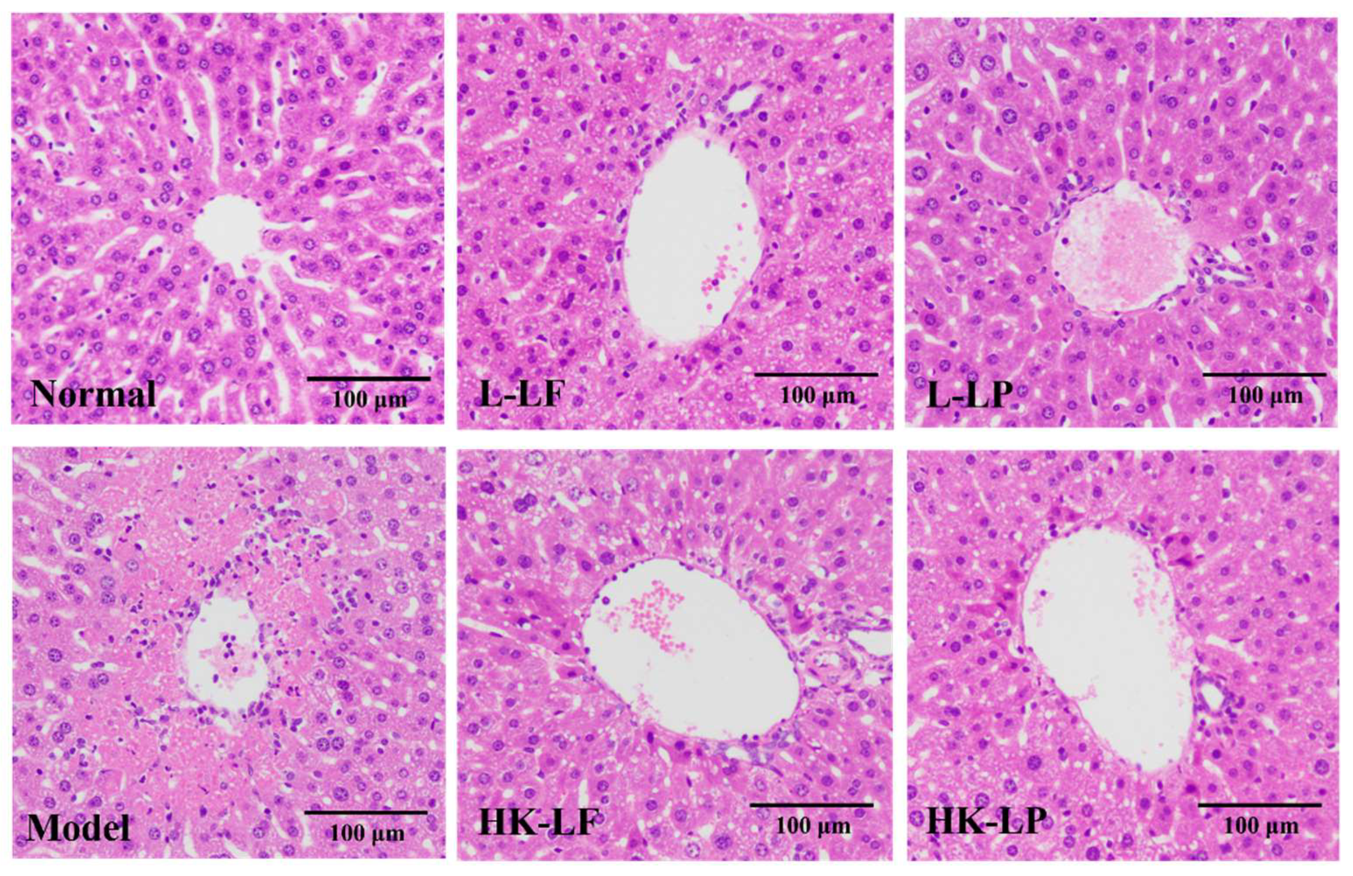 IJMS | Free Full-Text | Hepatoprotective Effects of Lactobacillus on ...