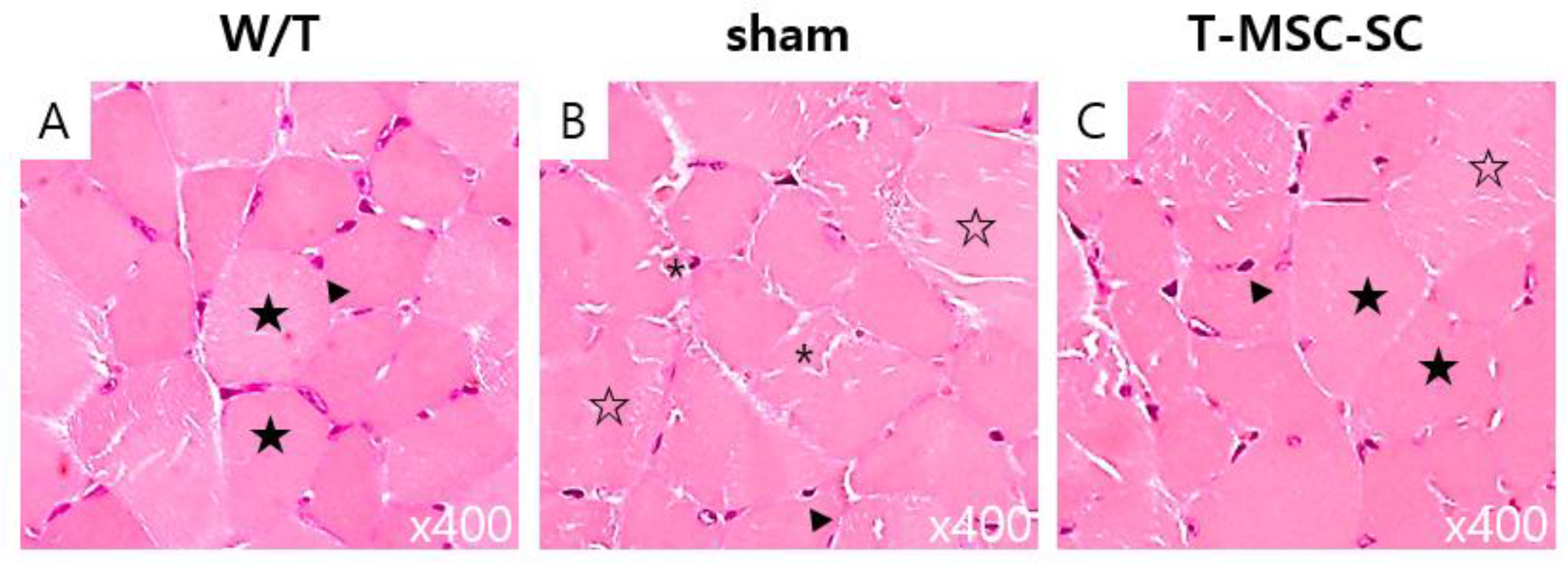 Ijms Free Full Text Differentiation Of Human Tonsil Derived Mesenchymal Stem Cells Into Schwann Like Cells Improves Neuromuscular Function In A Mouse Model Of Charcot Marie Tooth Disease Type 1a Html