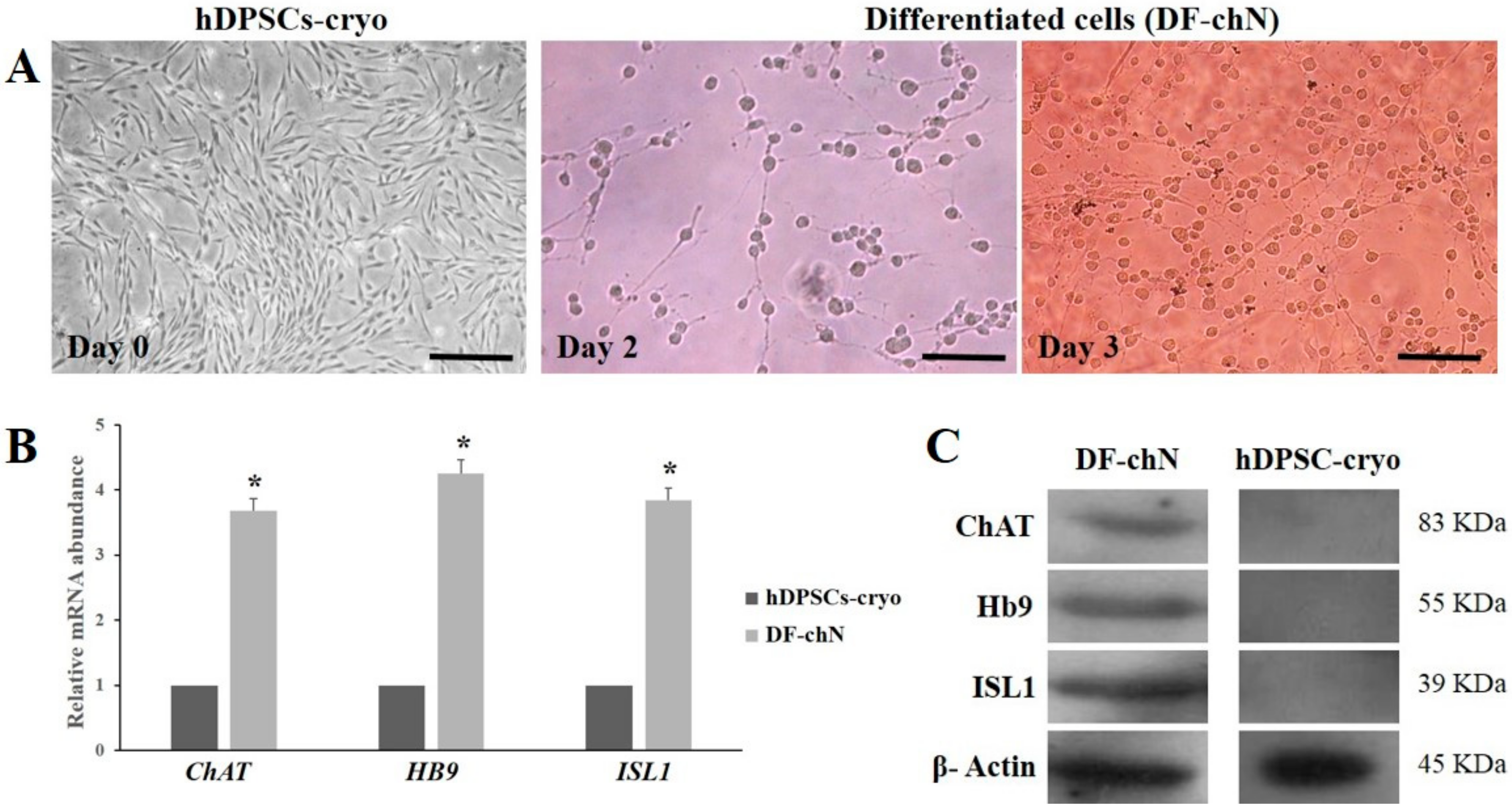 Markers of neuronal differentiation. Genetor potential of analyser. Differentiating Cells and developing Tissues are more vulnerable to alcohol than already differentiated Cells.. 5-Part Differential Cell Counter:.