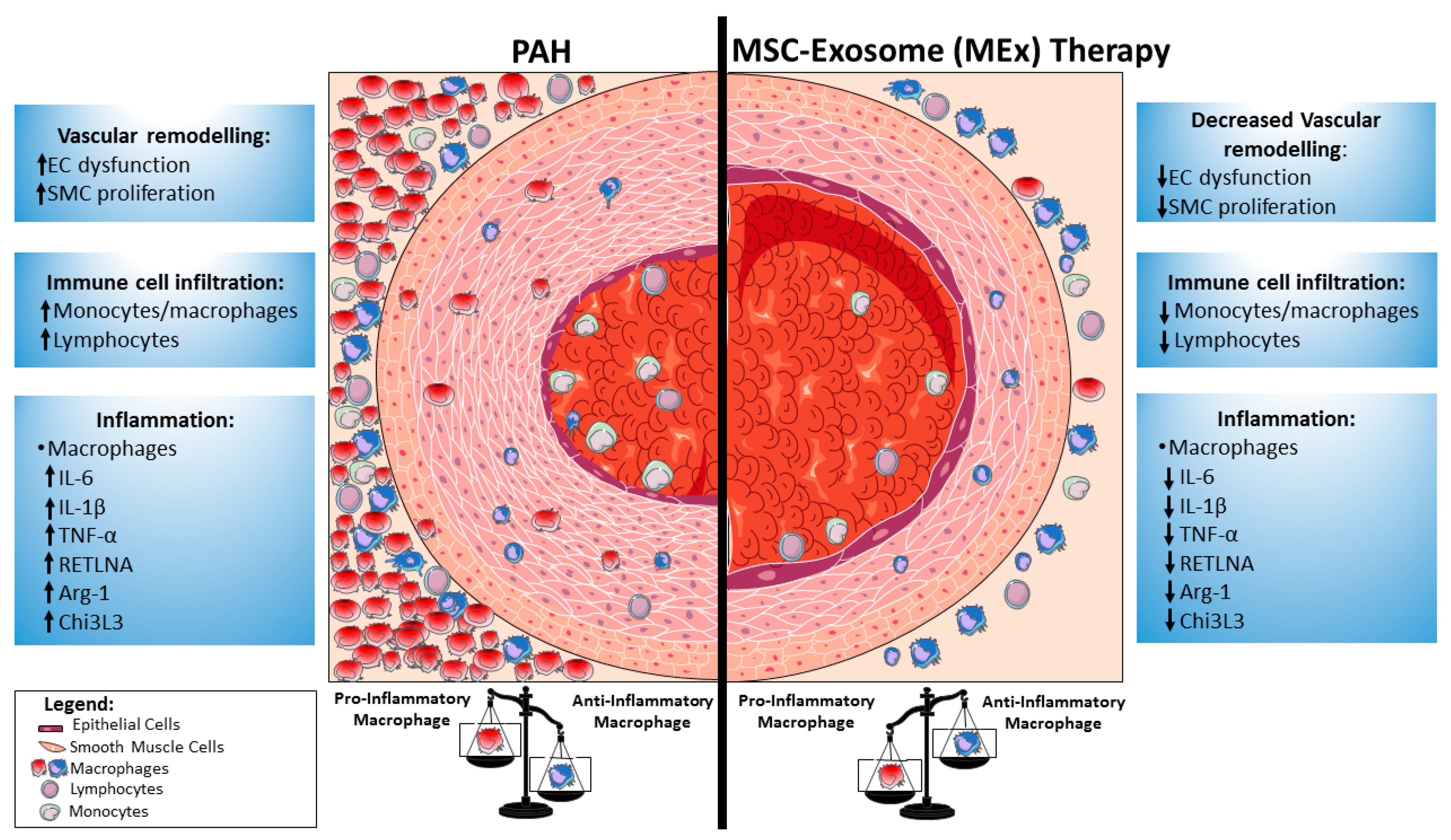 Ijms Free Full Text Macrophage Immunomodulation The Gatekeeper For Mesenchymal Stem Cell Derived Exosomes In Pulmonary Arterial Hypertension Html